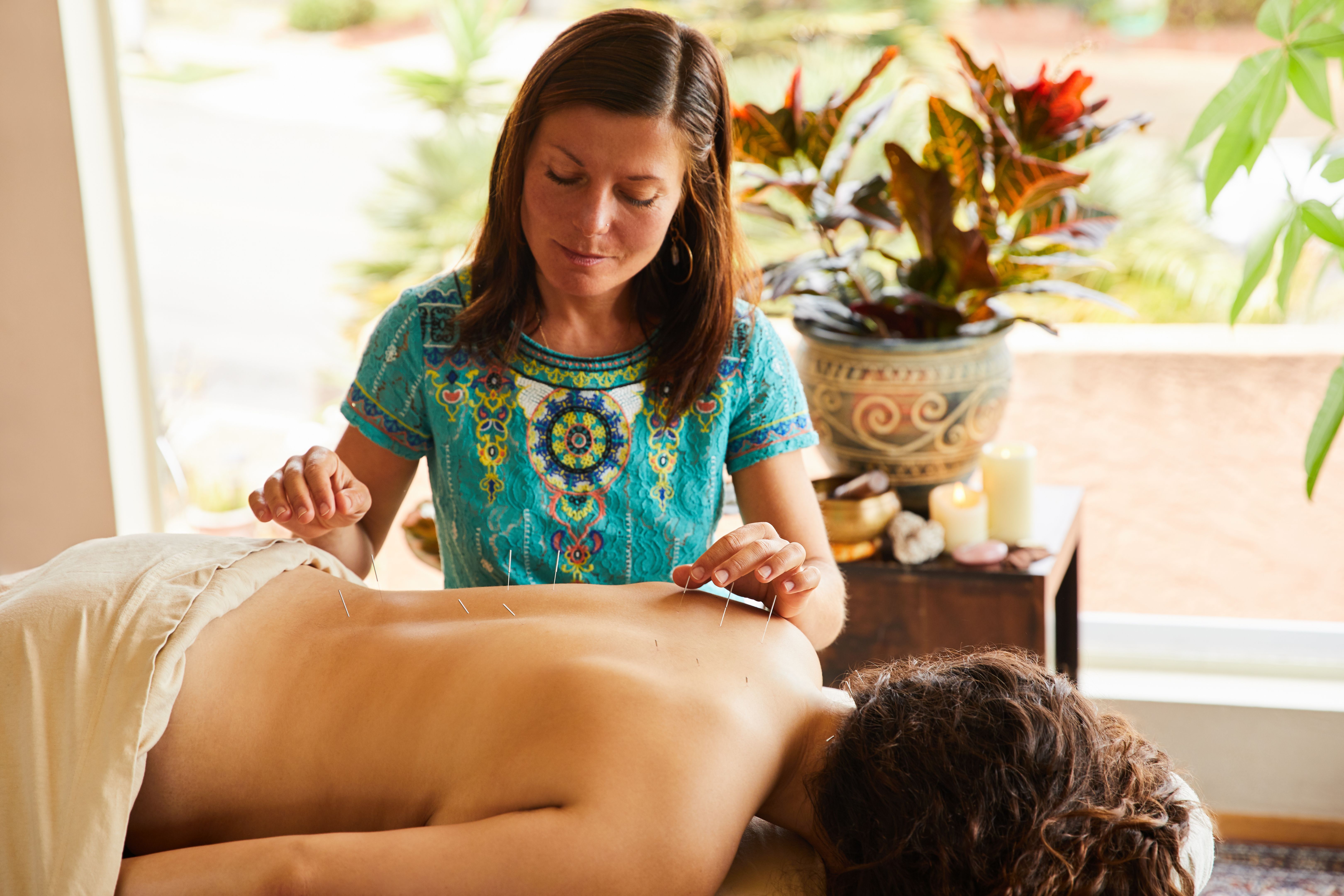 reiki acupuncture