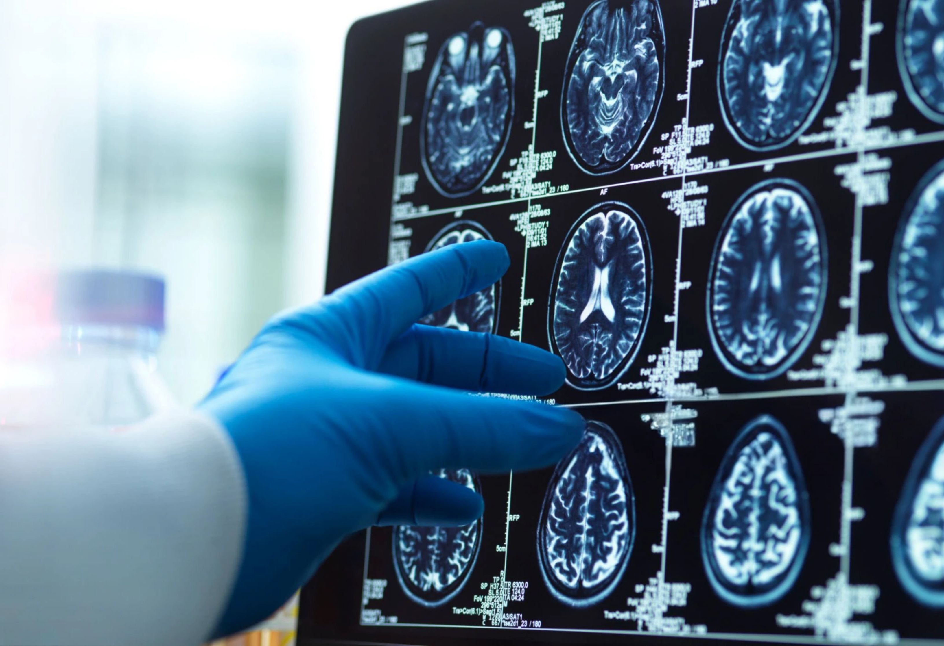 medical imaging