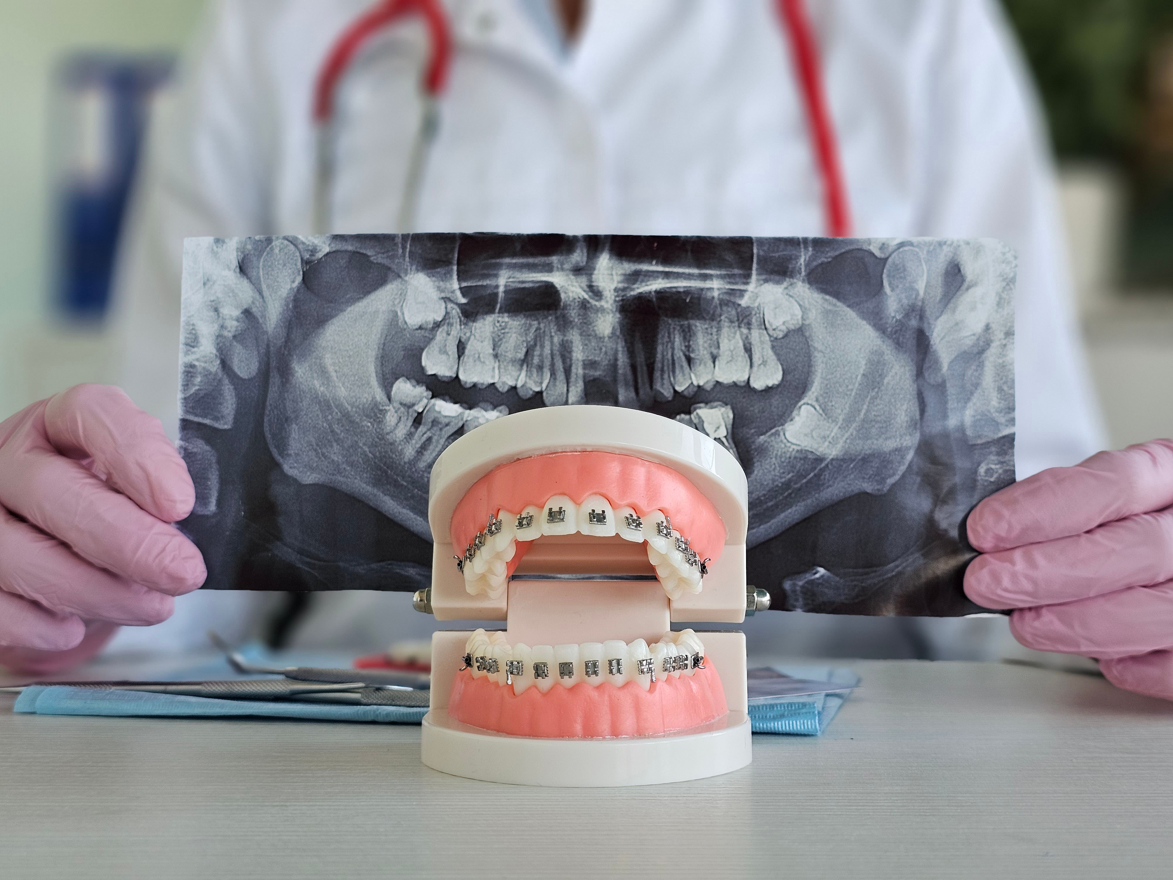 orthodontist consultation