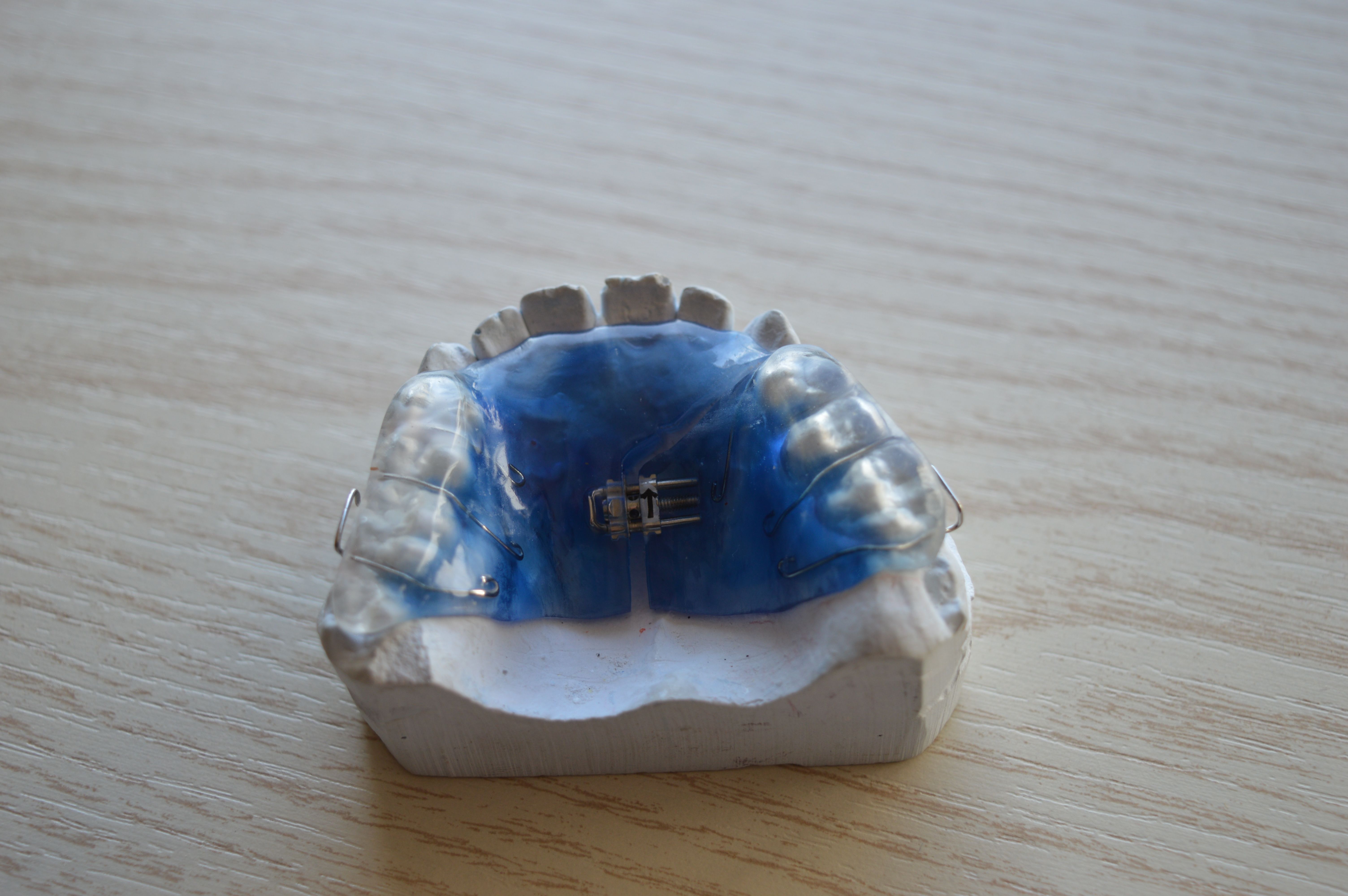 apparecchio ortodontico