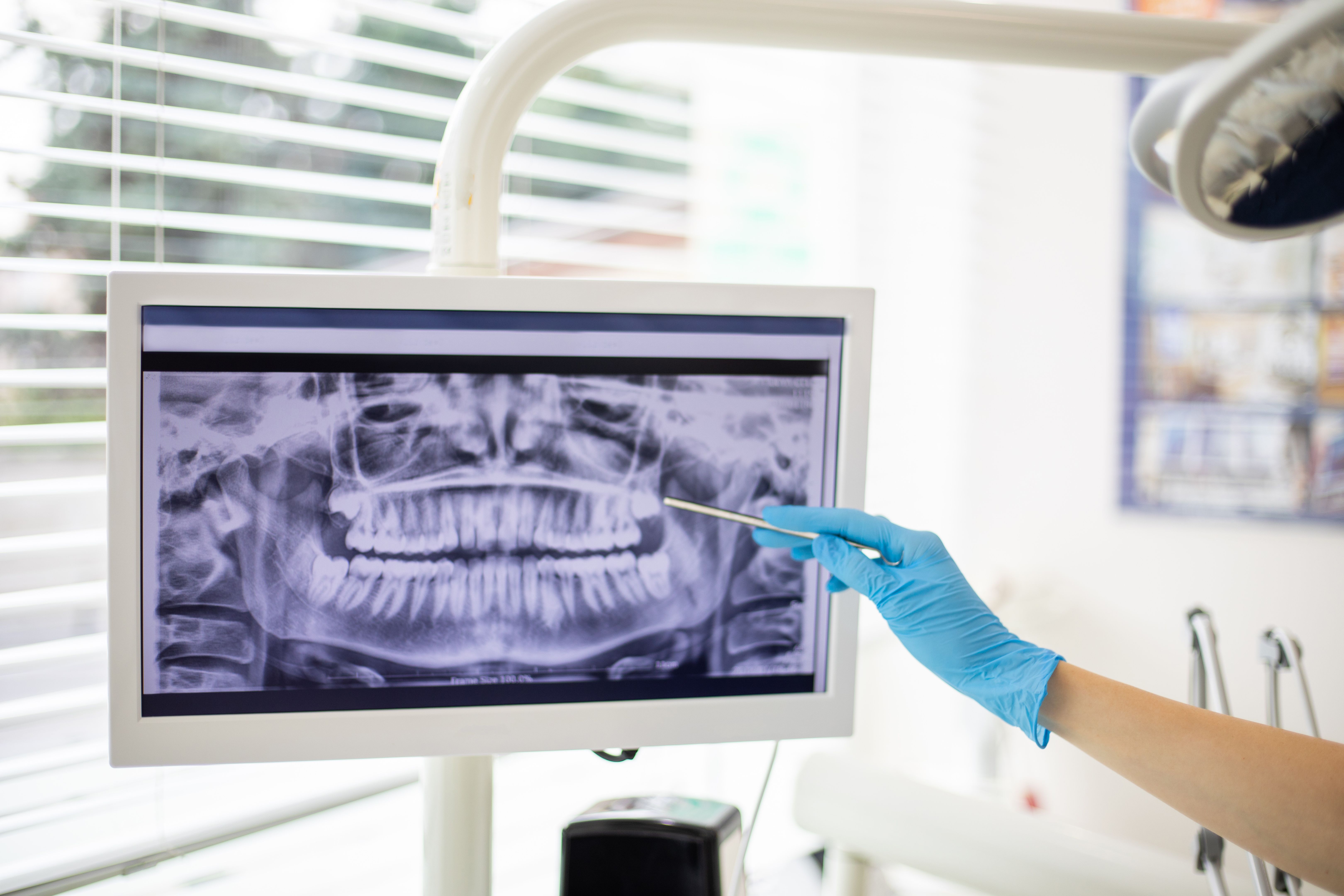 digital dental imaging