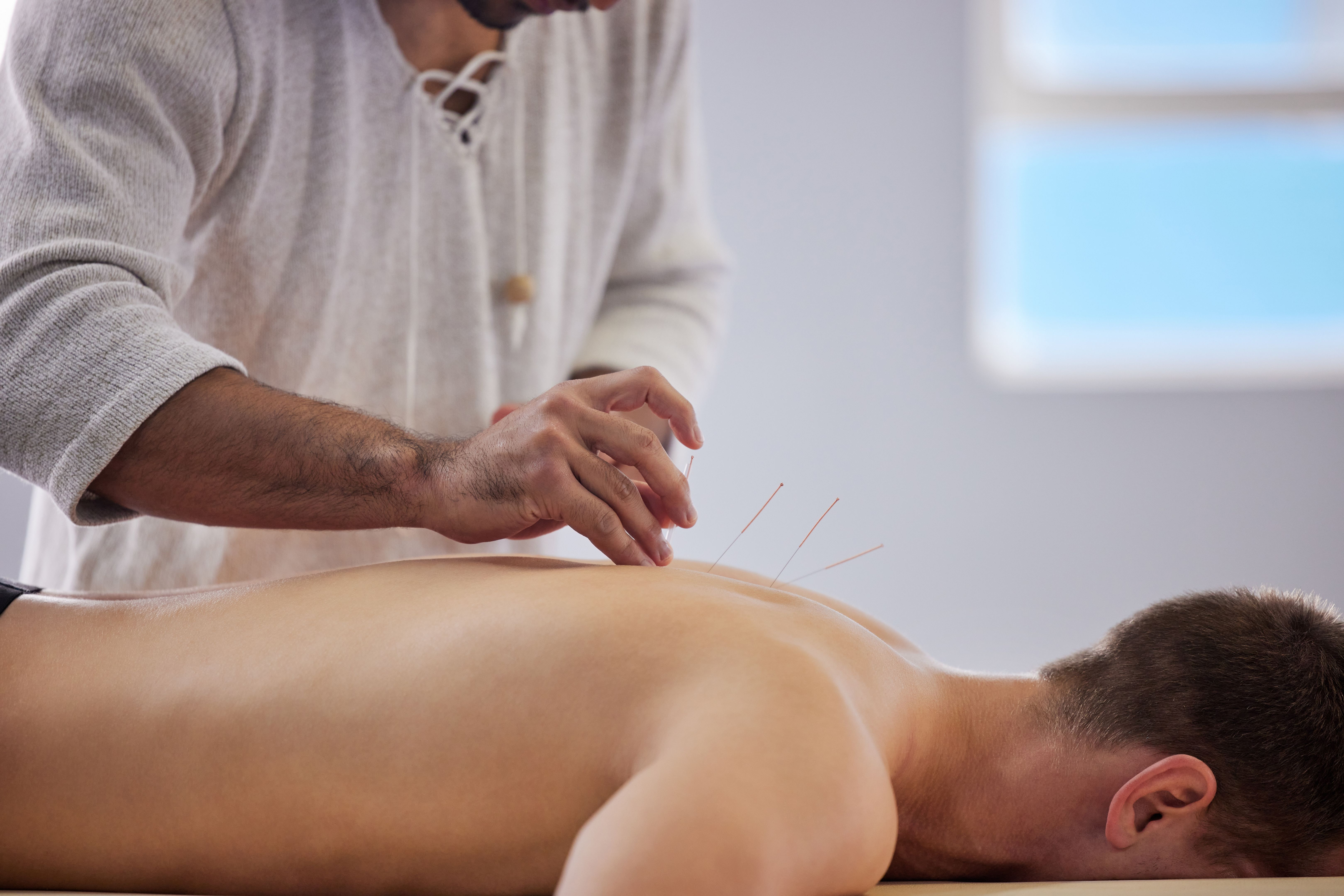 acupuncture therapy