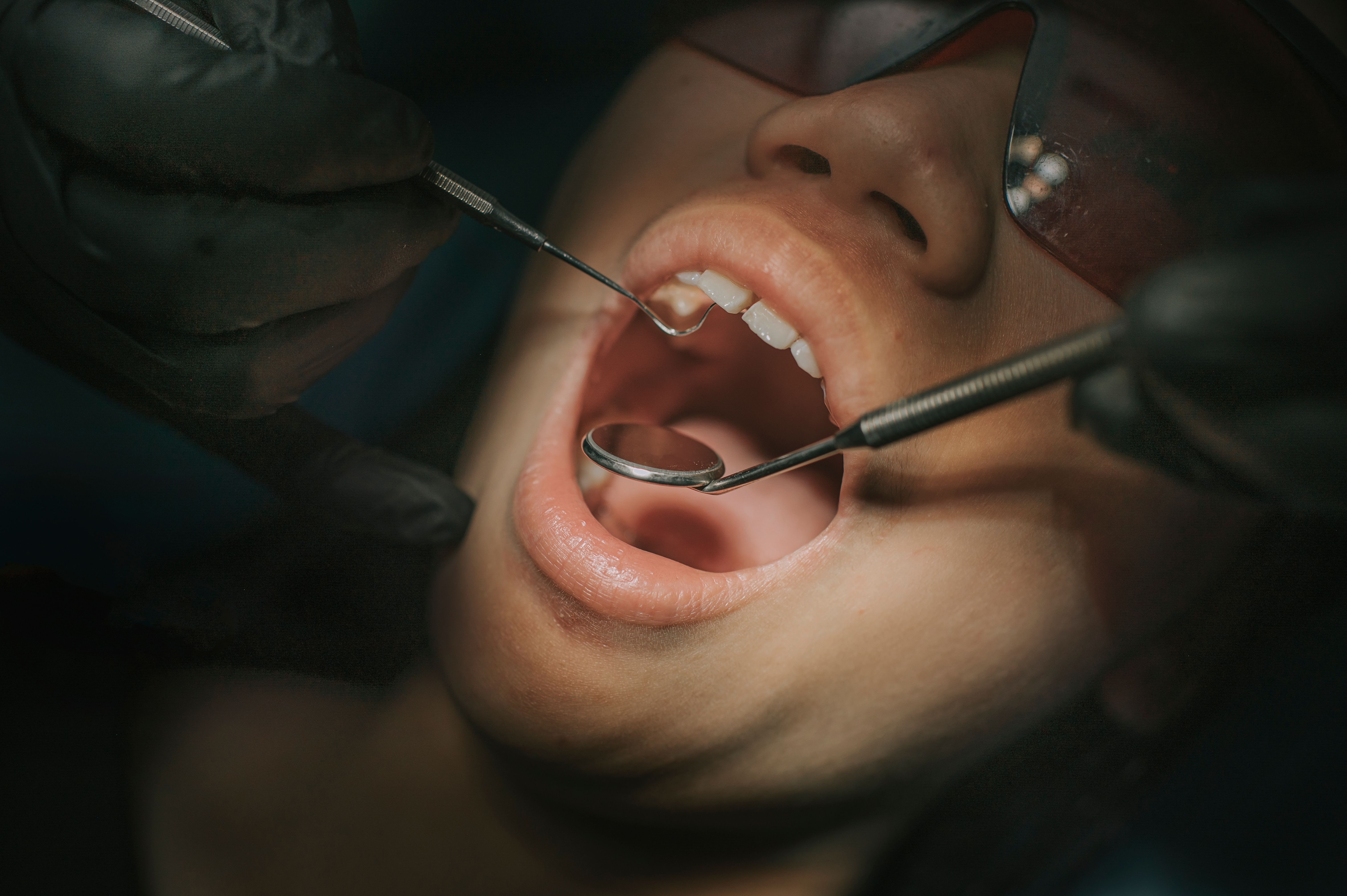 dental maintenance