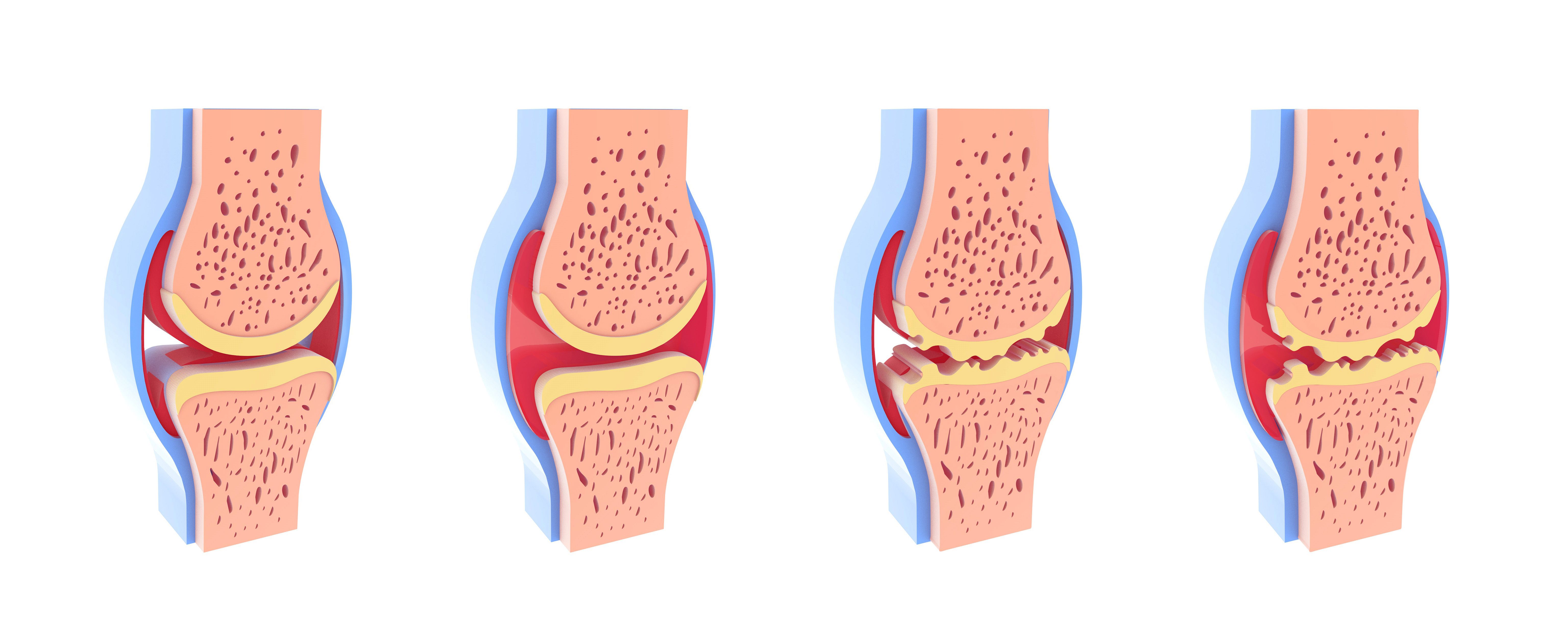 3d illustration of healthy and spherical synovial joint. 3d illustration of healthy and spherical synovial joint.