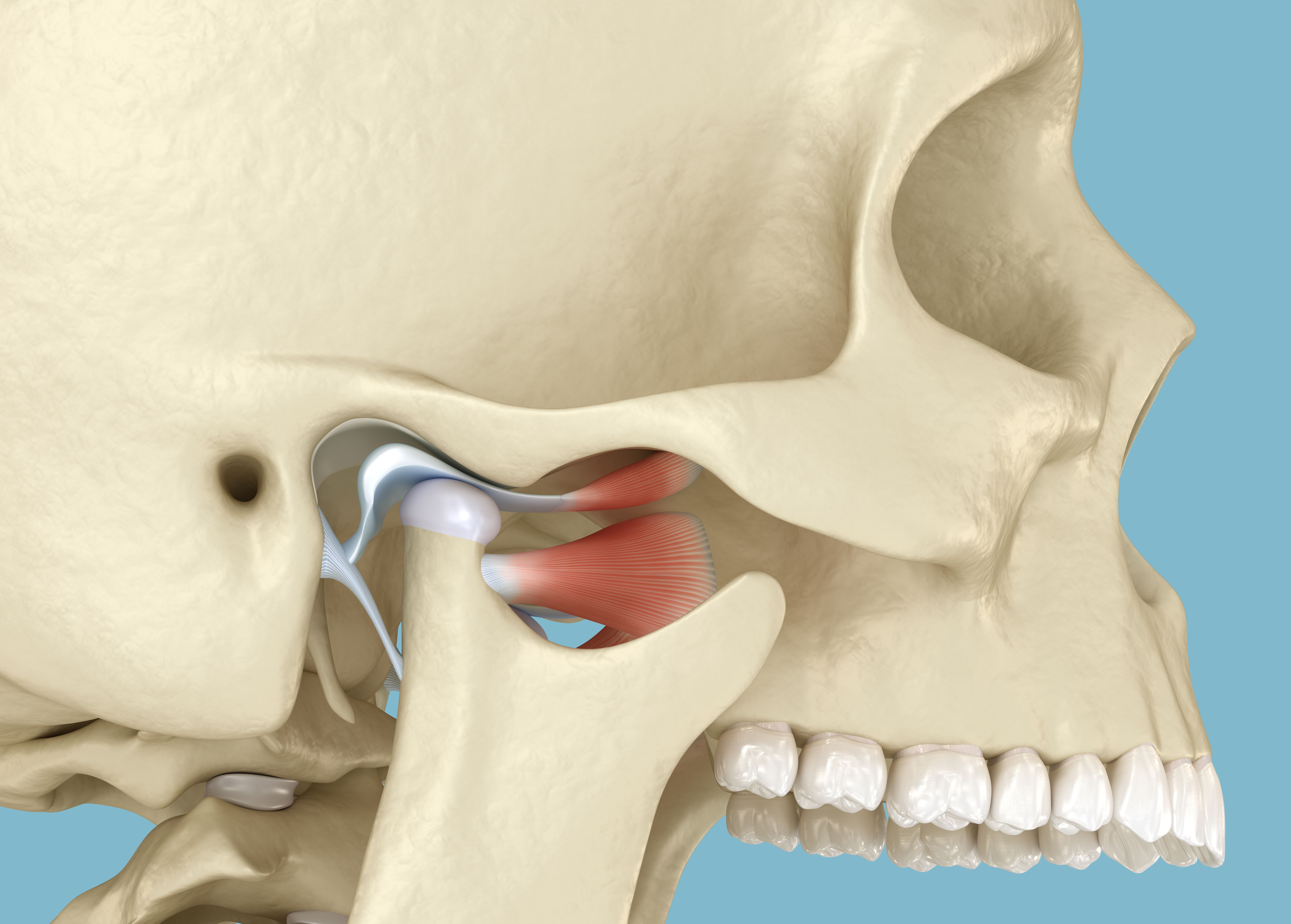 TMJ: The temporomandibular joints dislocation. 3D illustration. TMJ: The temporomandibular joints dislocation. 3D illustration.