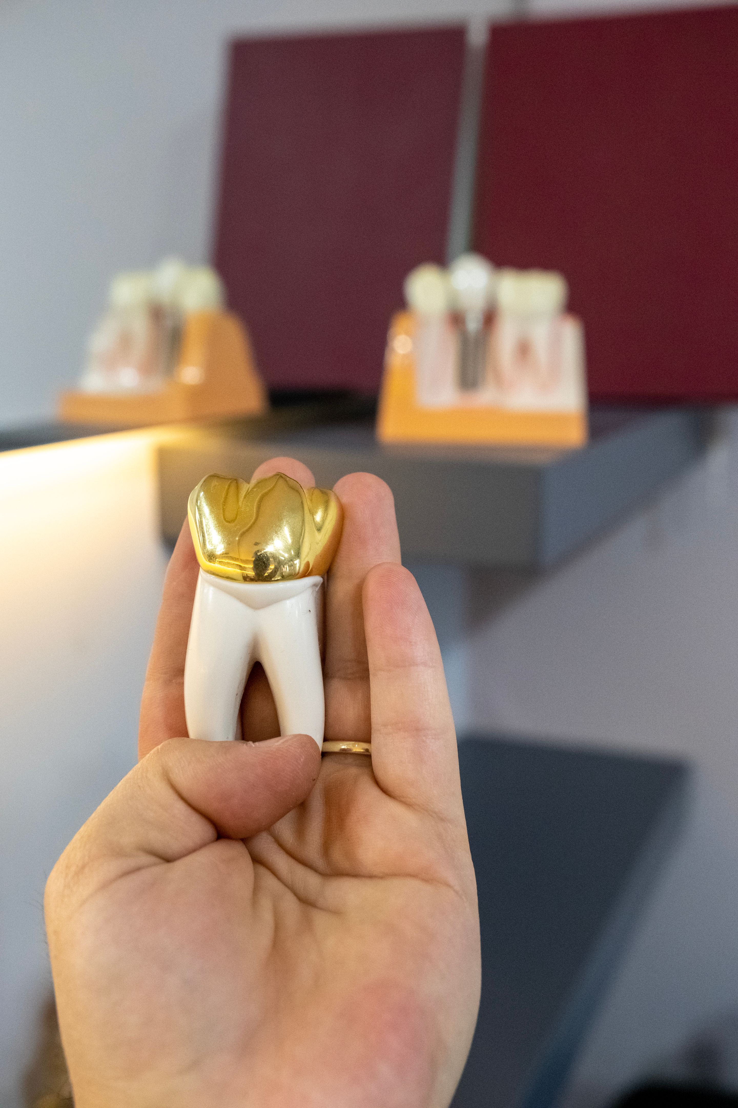 choosing dental bridge