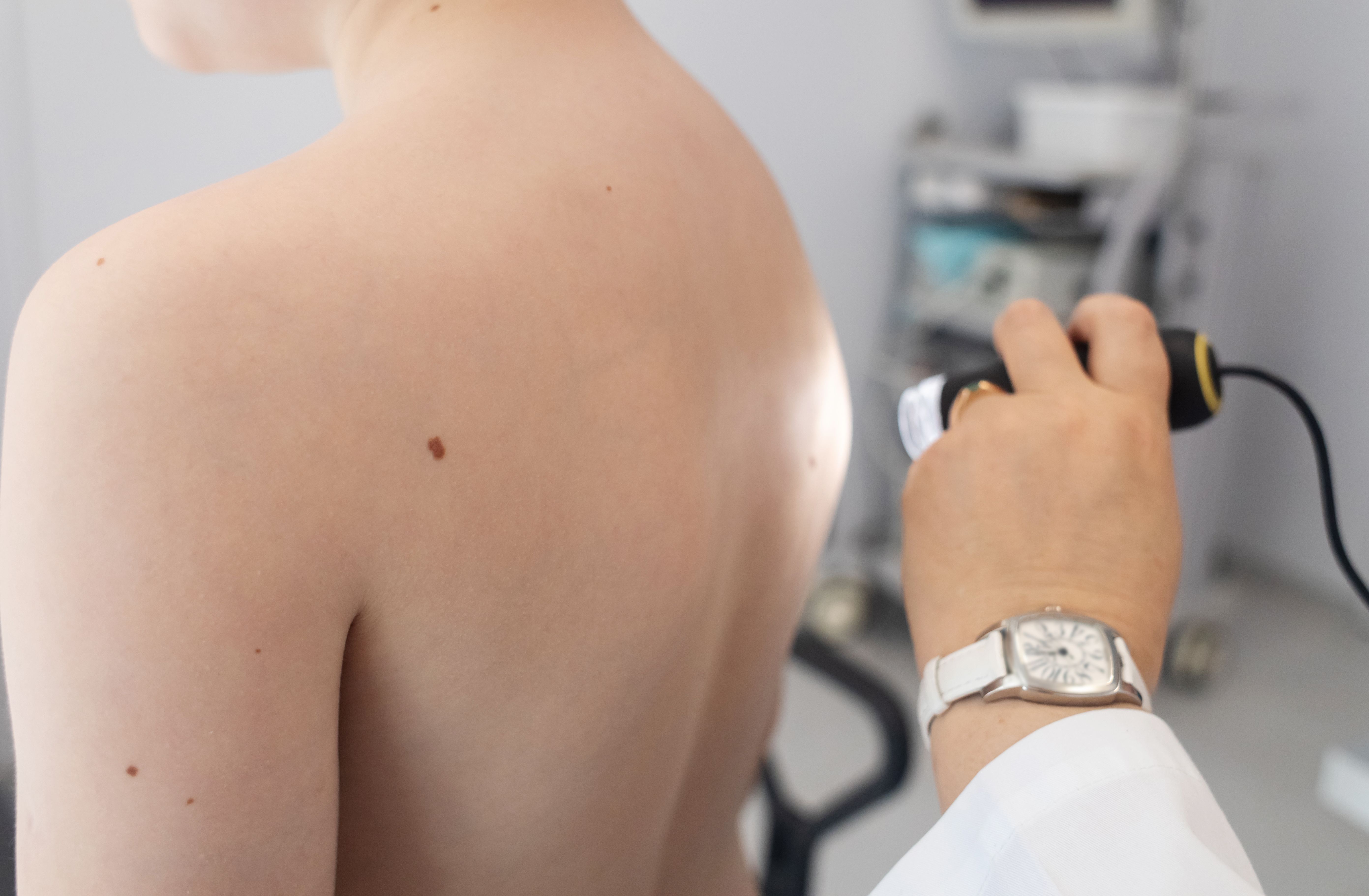 dermatologist consultation