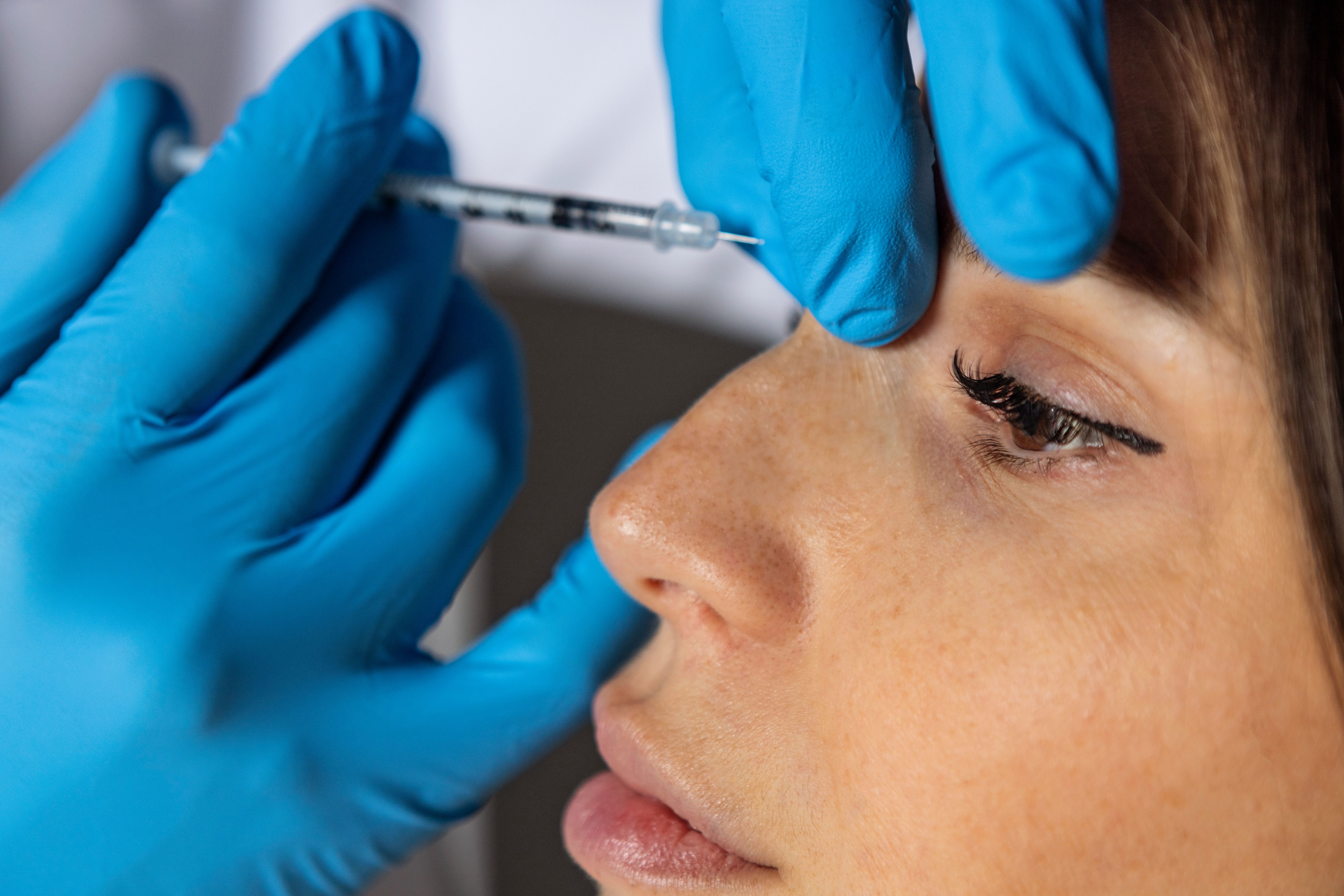 botulinum toxin