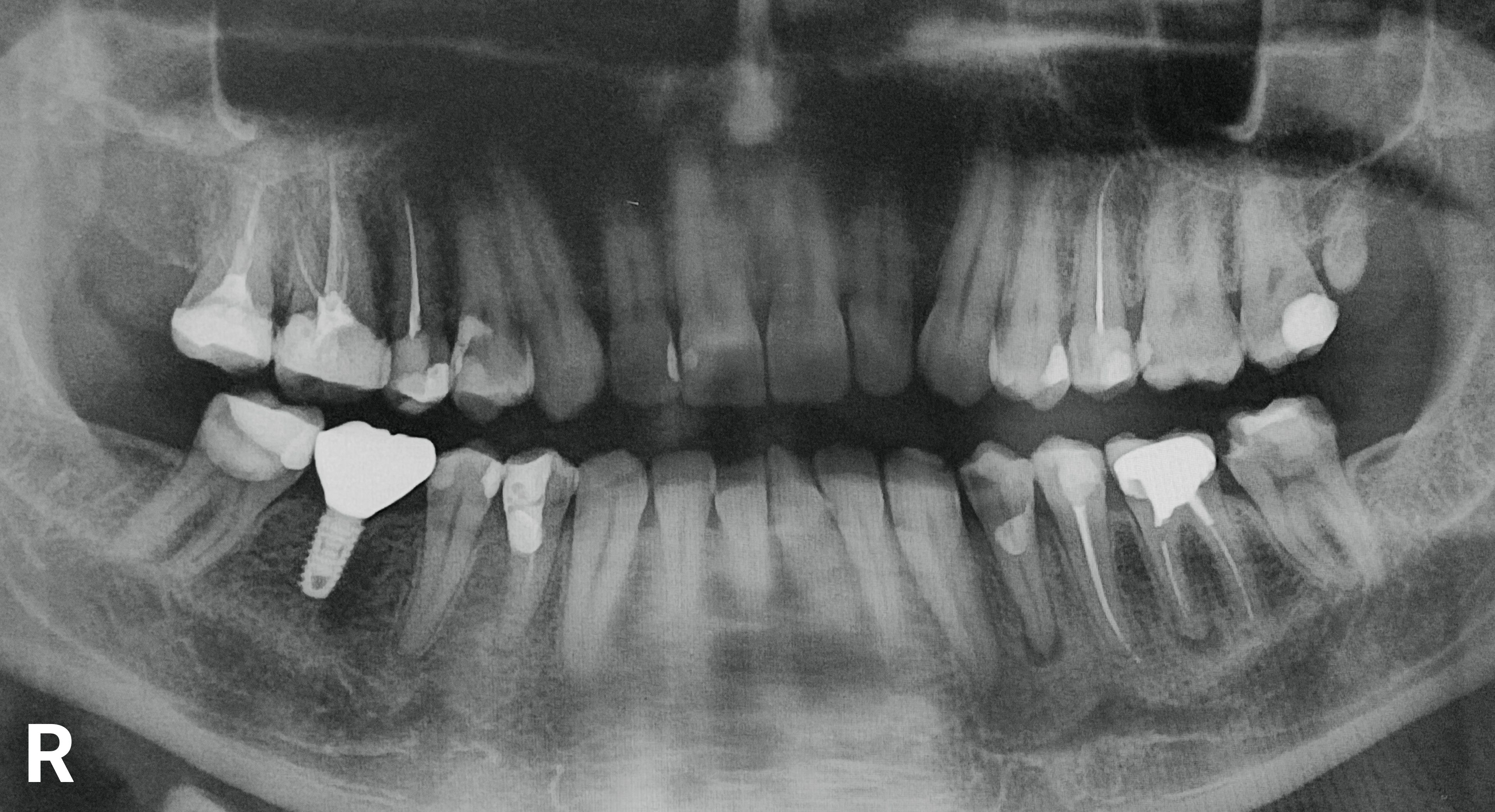 dental equipment regulations