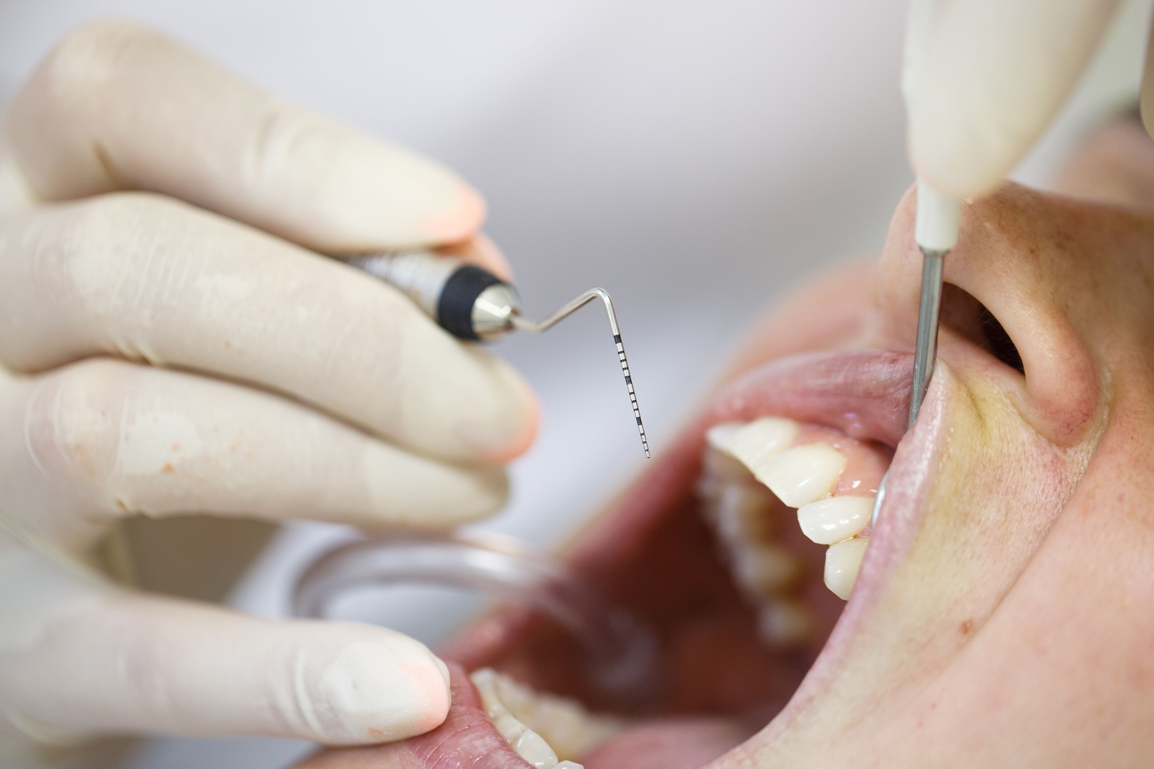 periodontal treatment