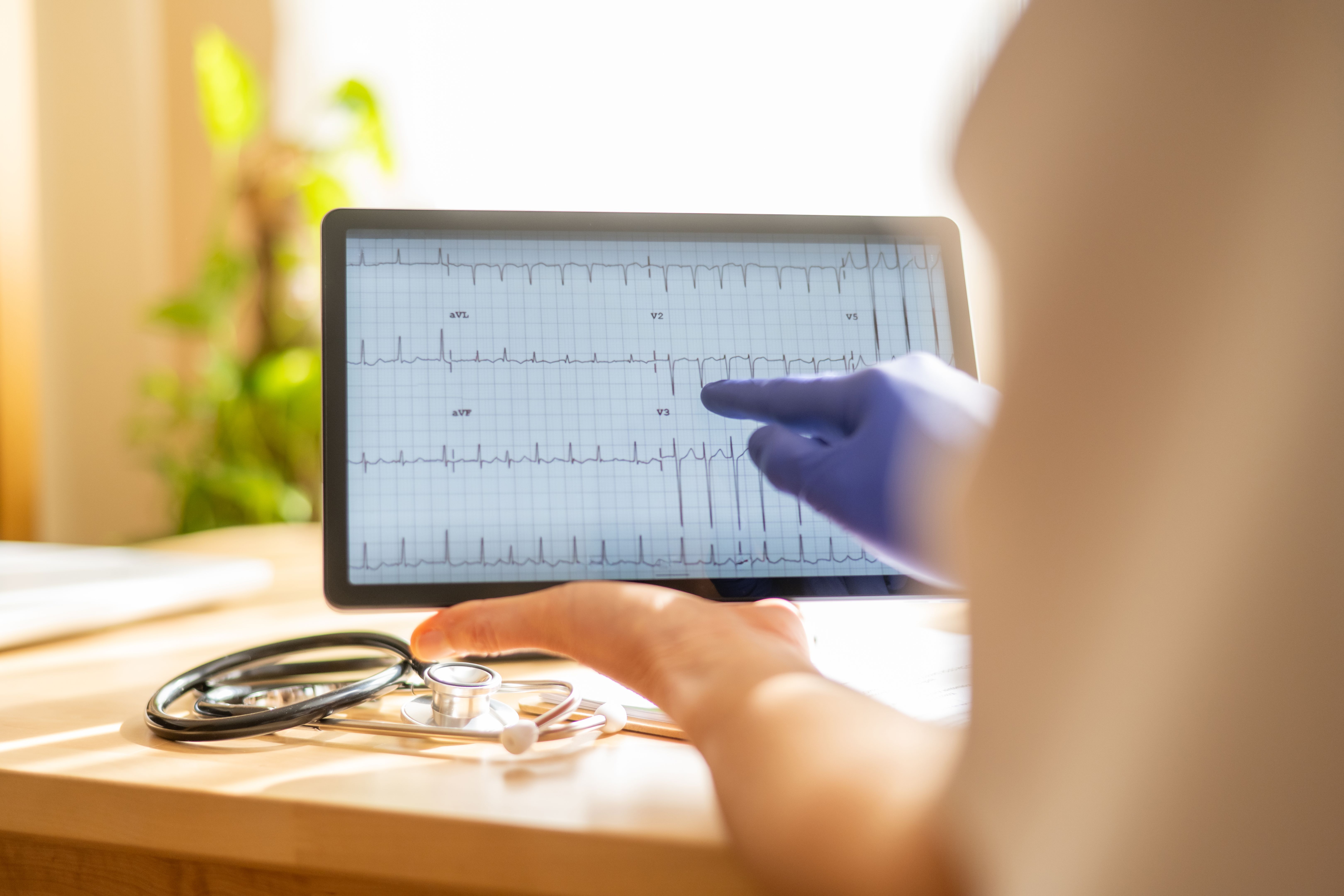 Doctor wearing blue gloves pointing at electrocardiogram on digital tablet, with stethoscope resting on desk in medical office, showcasing telemedicine and healthcare technology