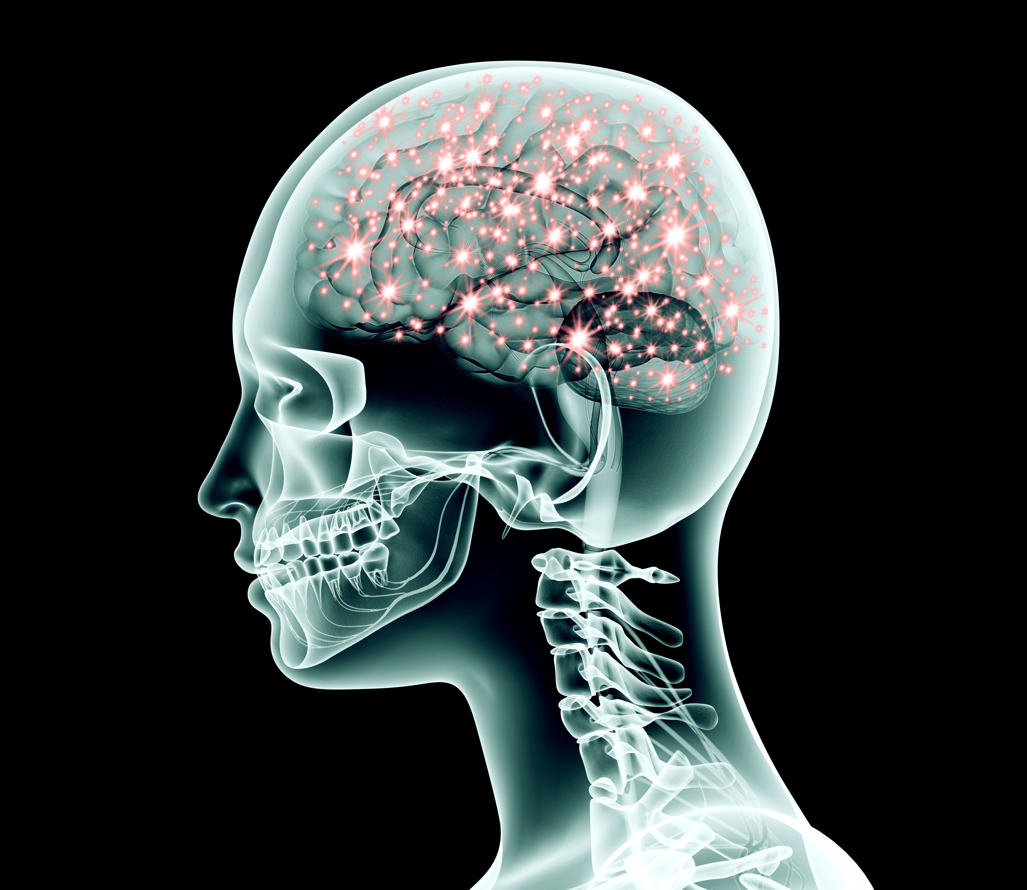 brain pain