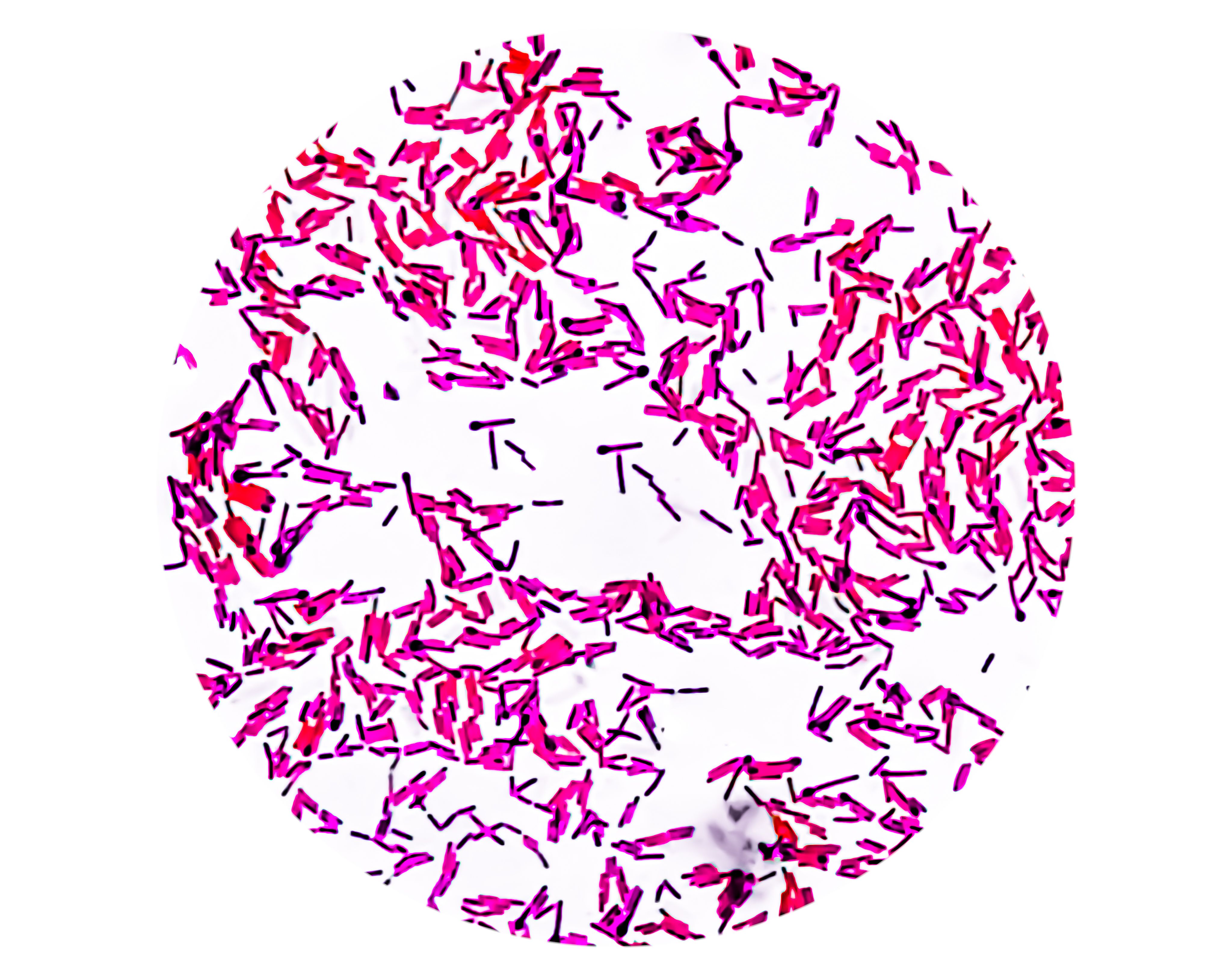 botulism bacteria