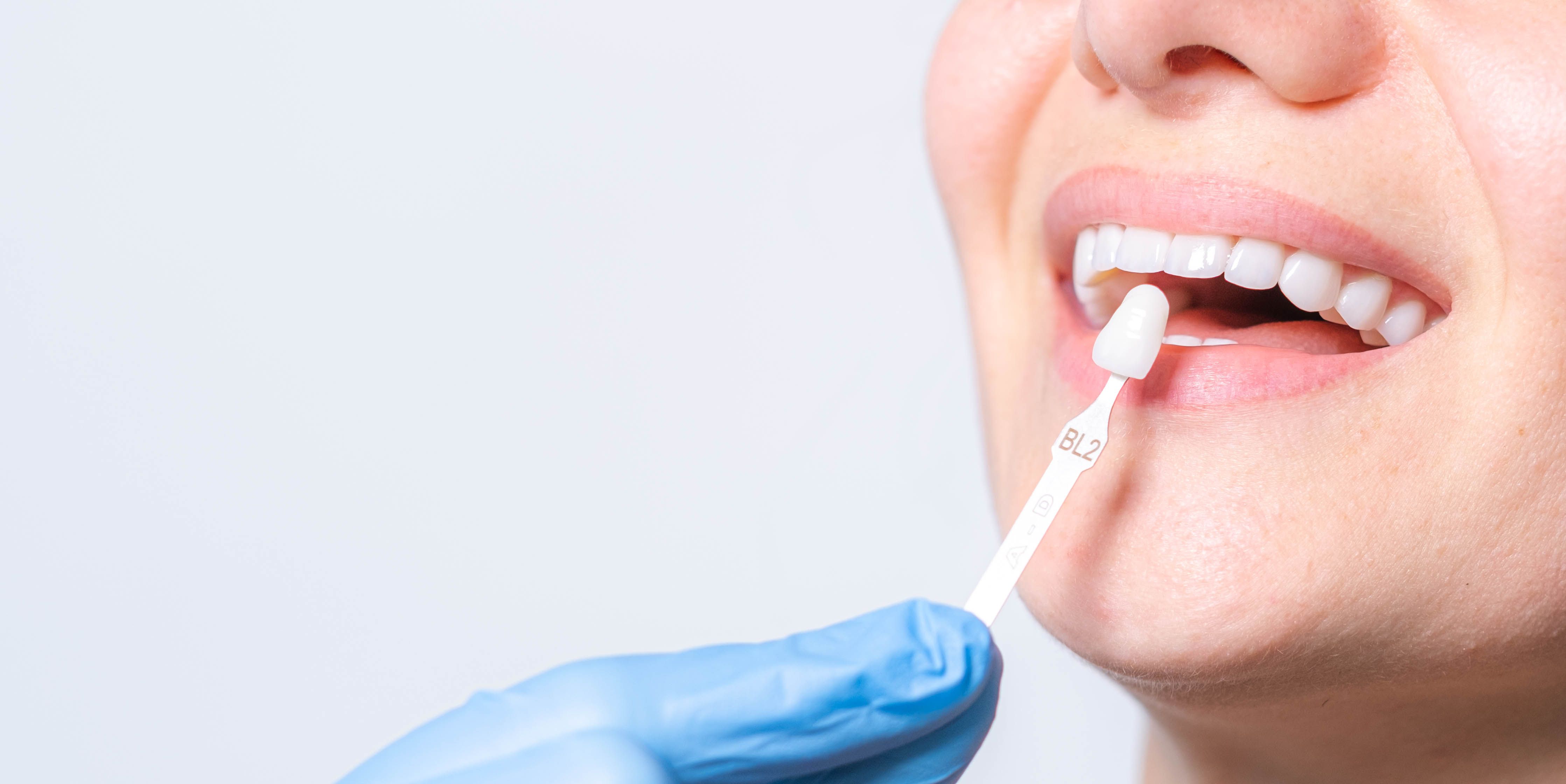 cosmetic dentistry