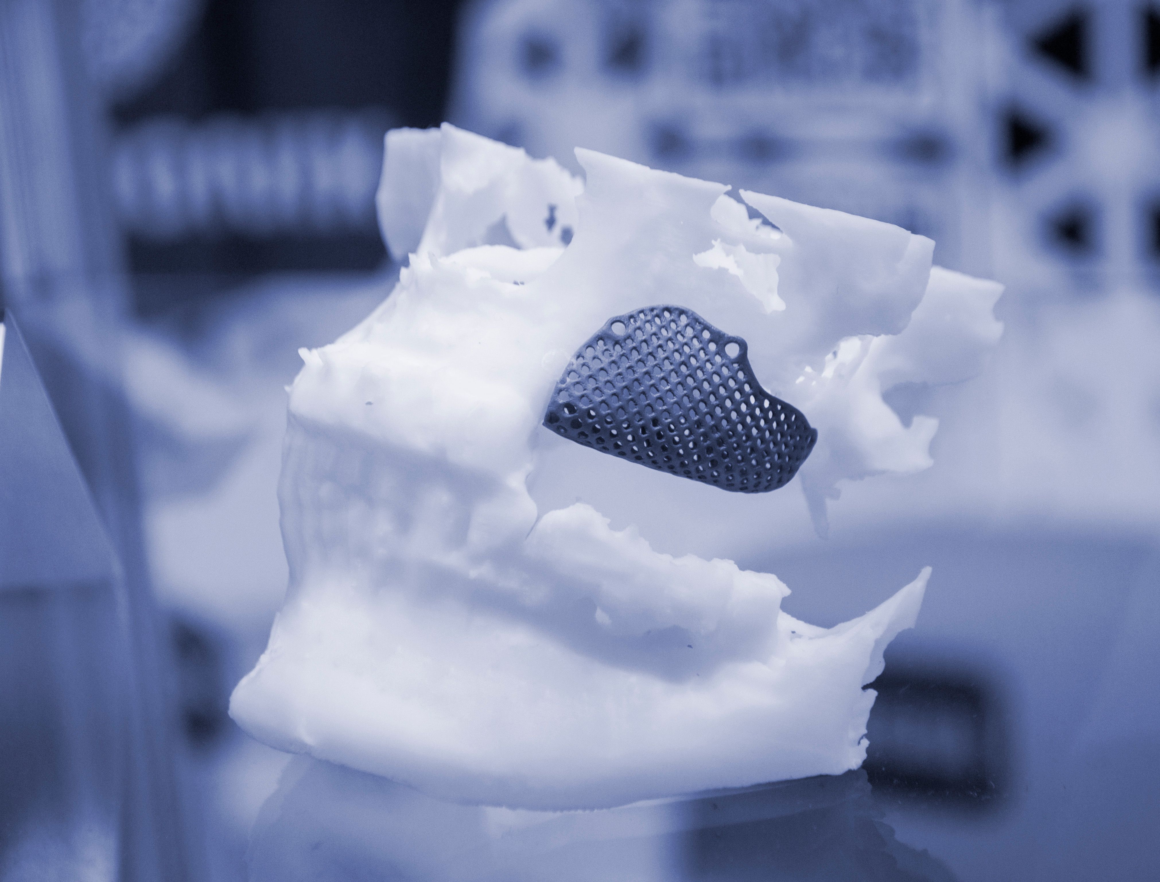 biocompatible implants