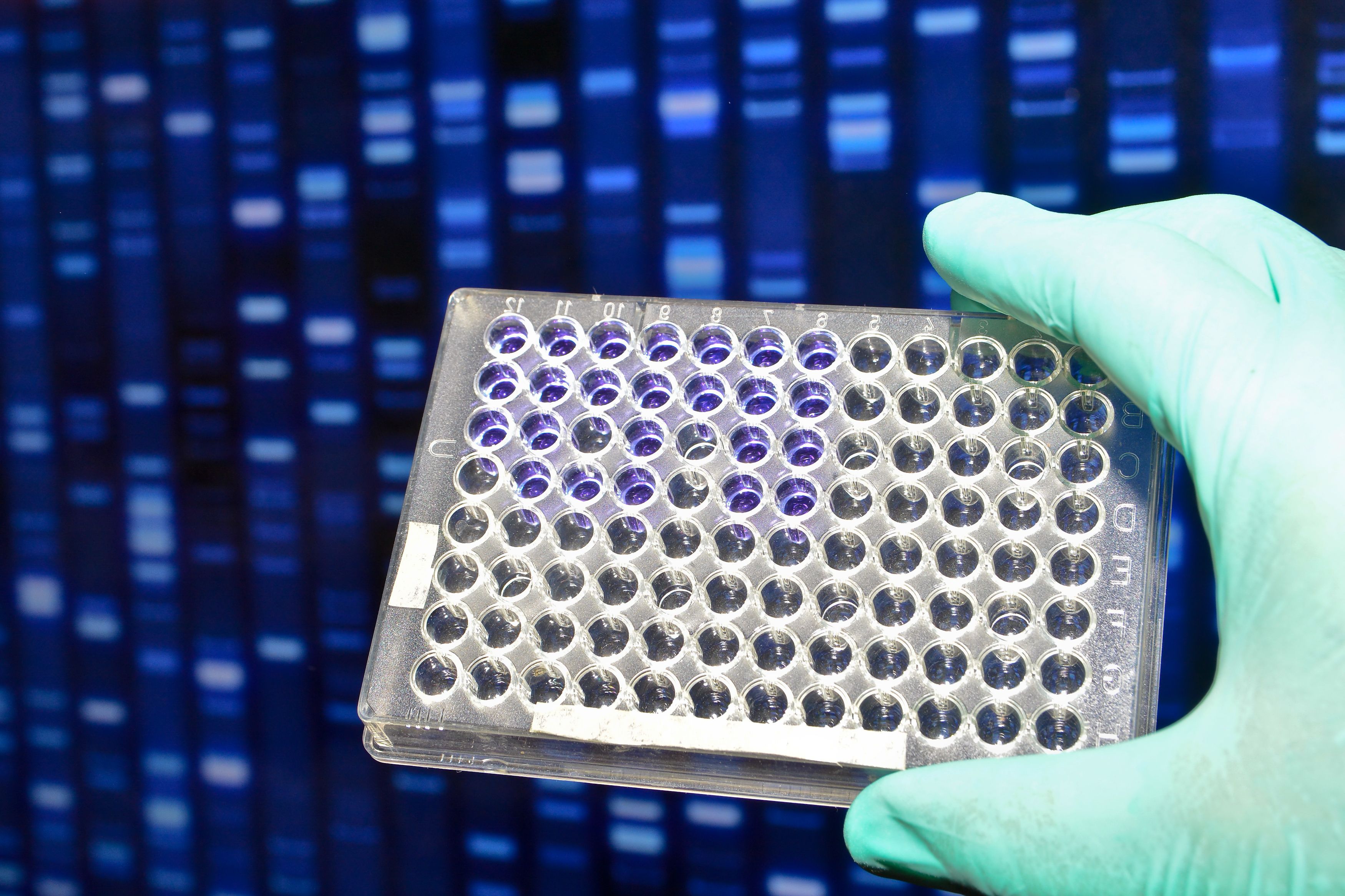 DNA testing in the laboratory.