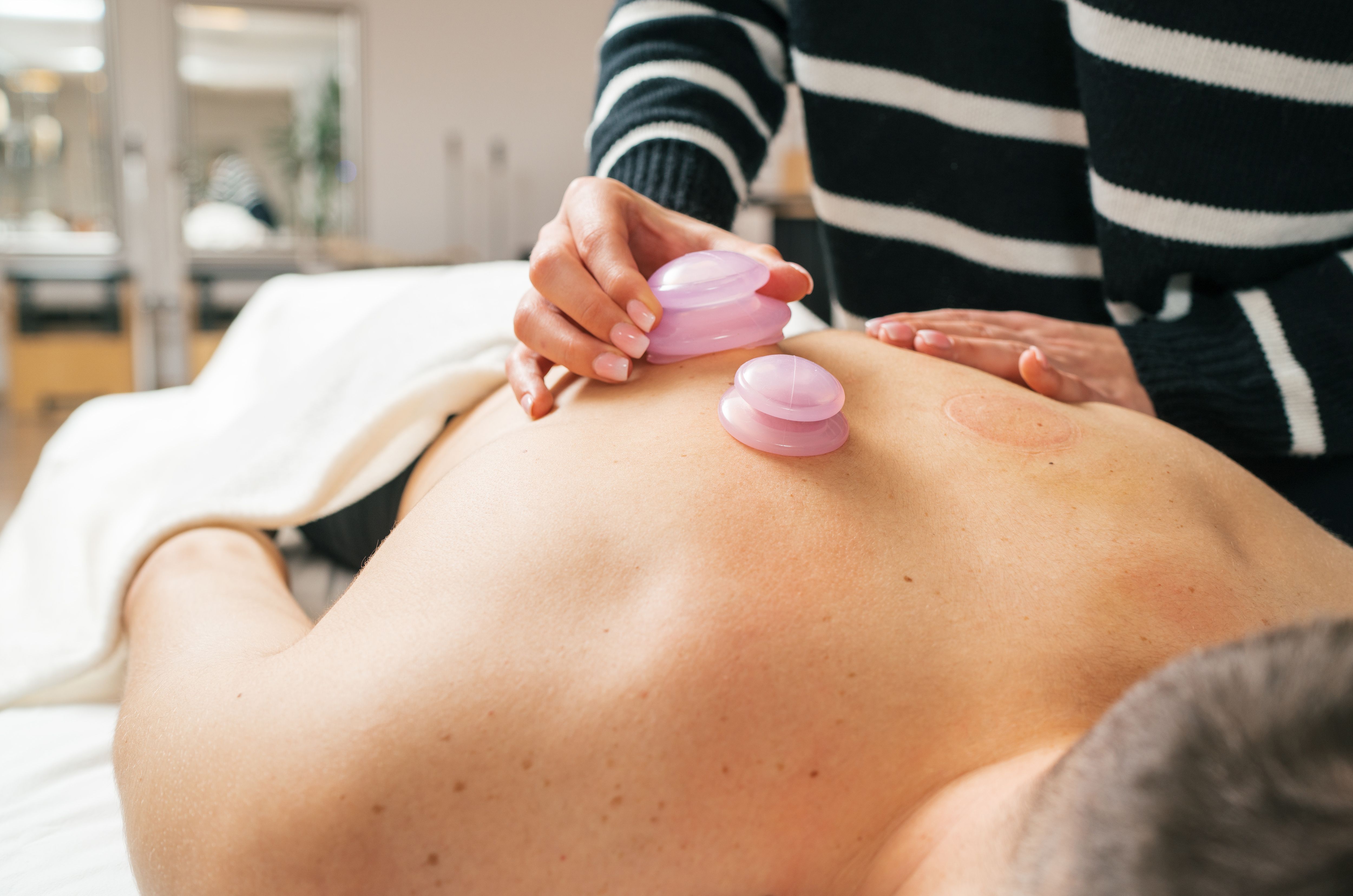 Therapist's hands performing vacuum cupping therapy treatment on female patient's skin. Image highlights relaxation and alternative medicine healthcare practices in traditional oriental clinic.
