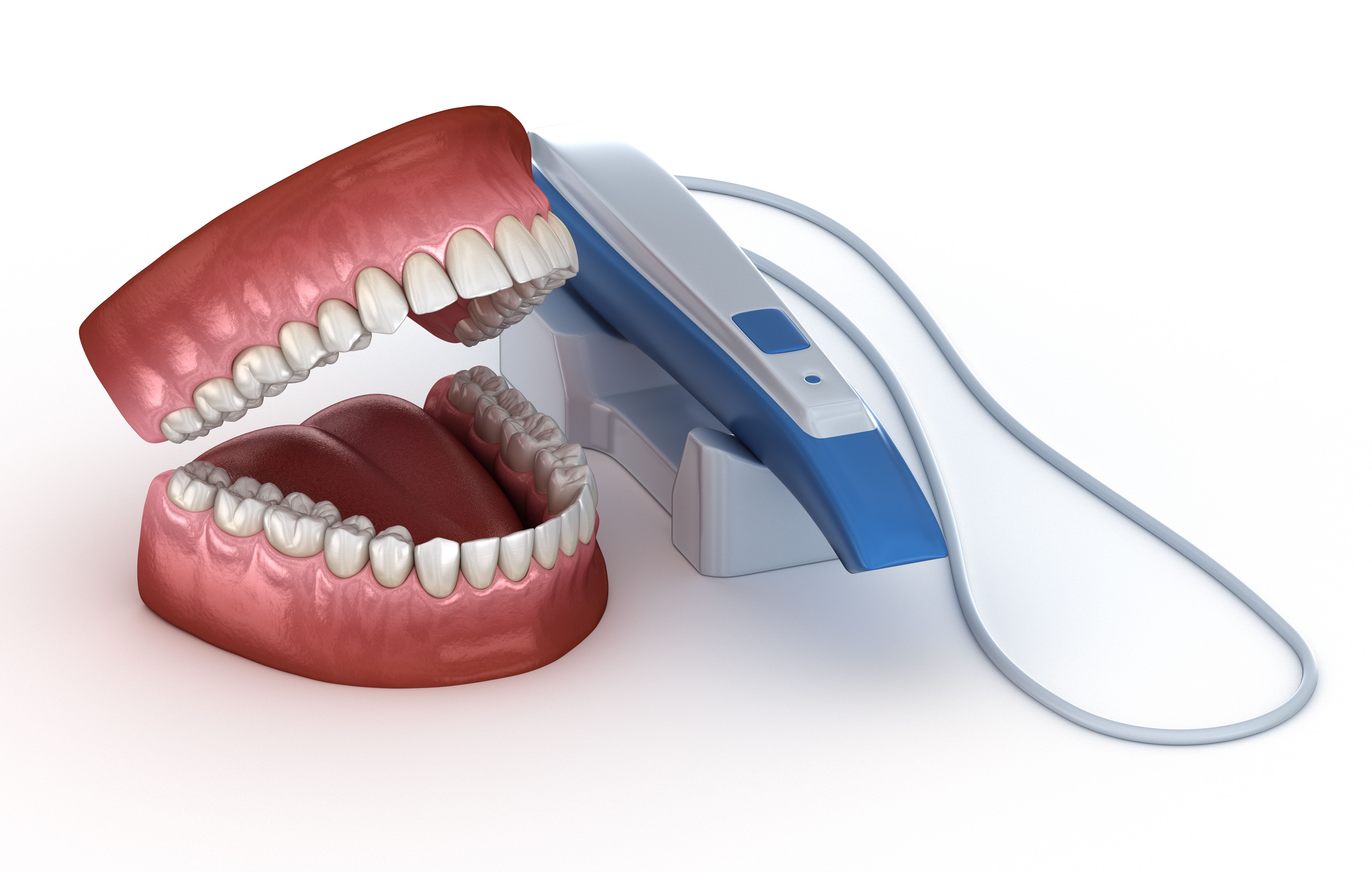 3d dental scan