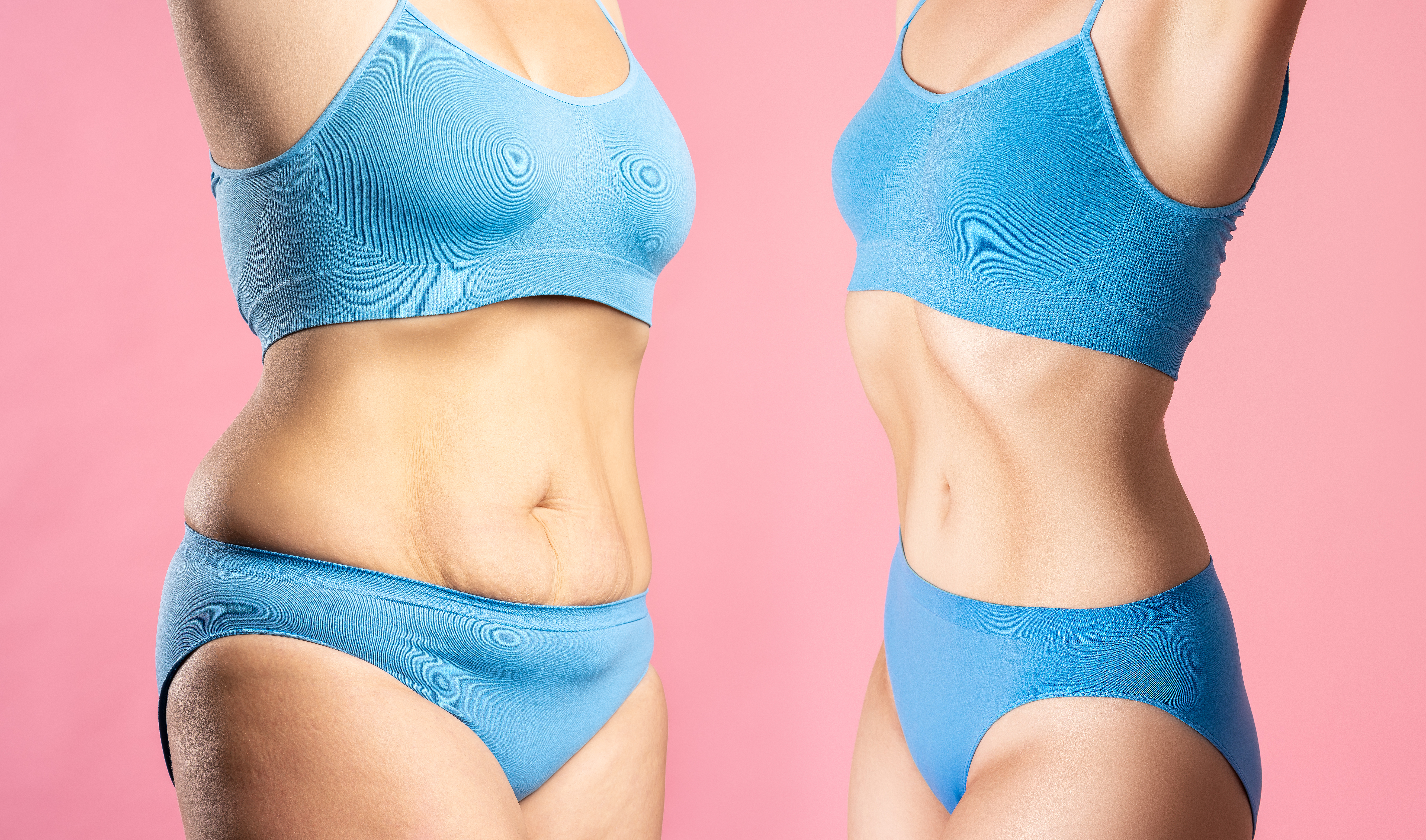 Woman's body before and after weight loss on pink background, plastic surgery and liposuction concept