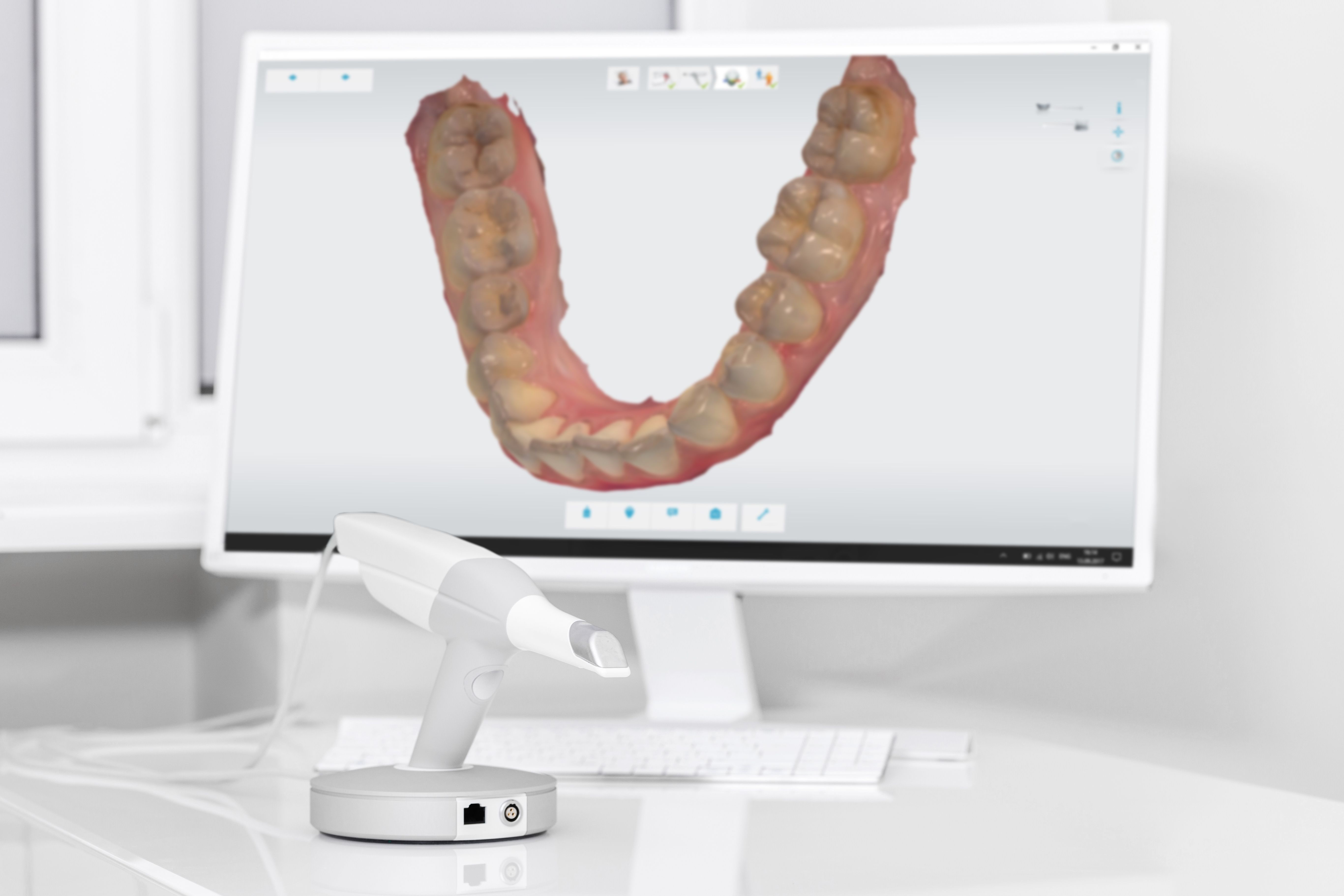 digital dental scanner