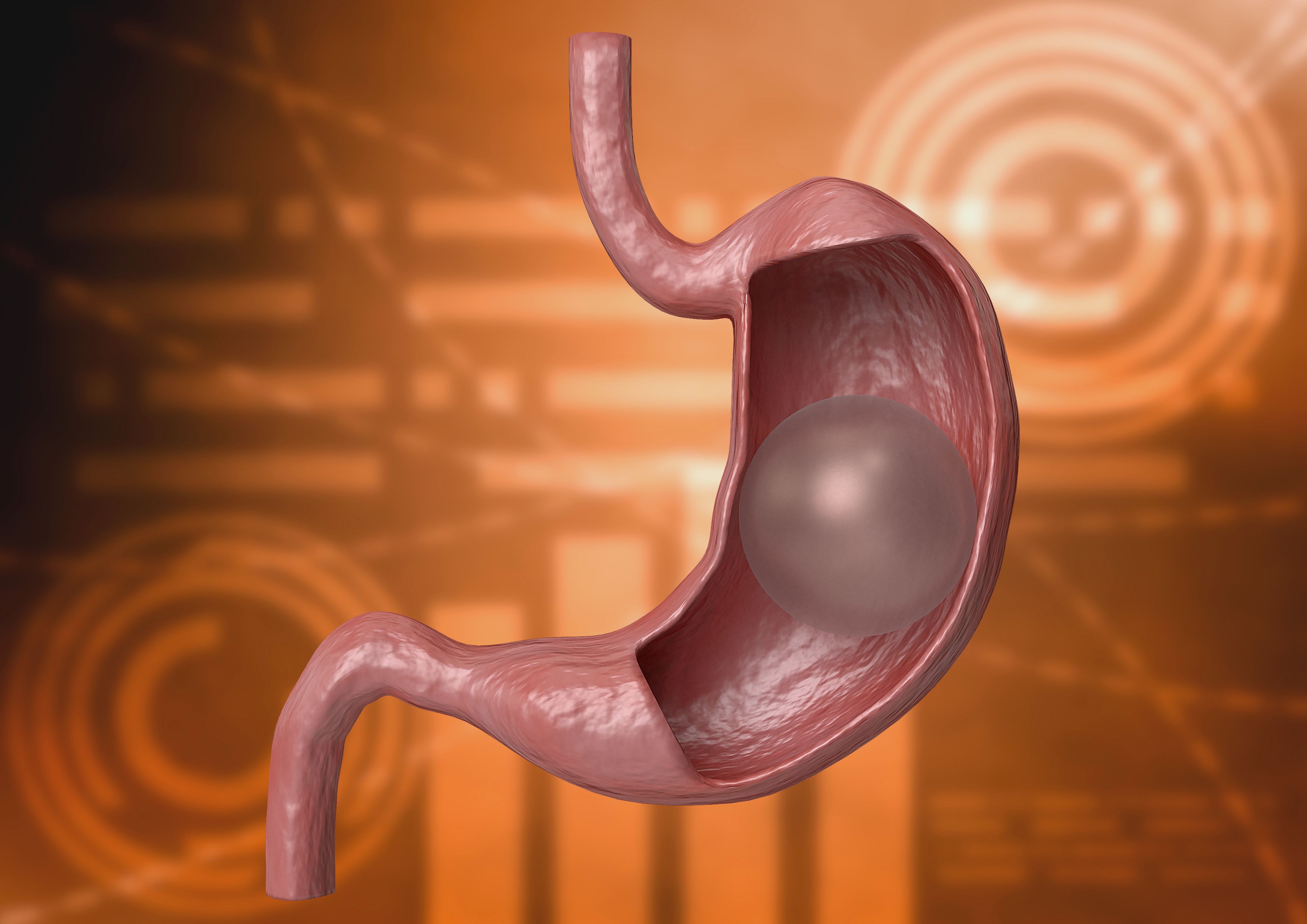 Balloon gastric 3D rendering. inflatable device that is placed in the stomach to reduce weight