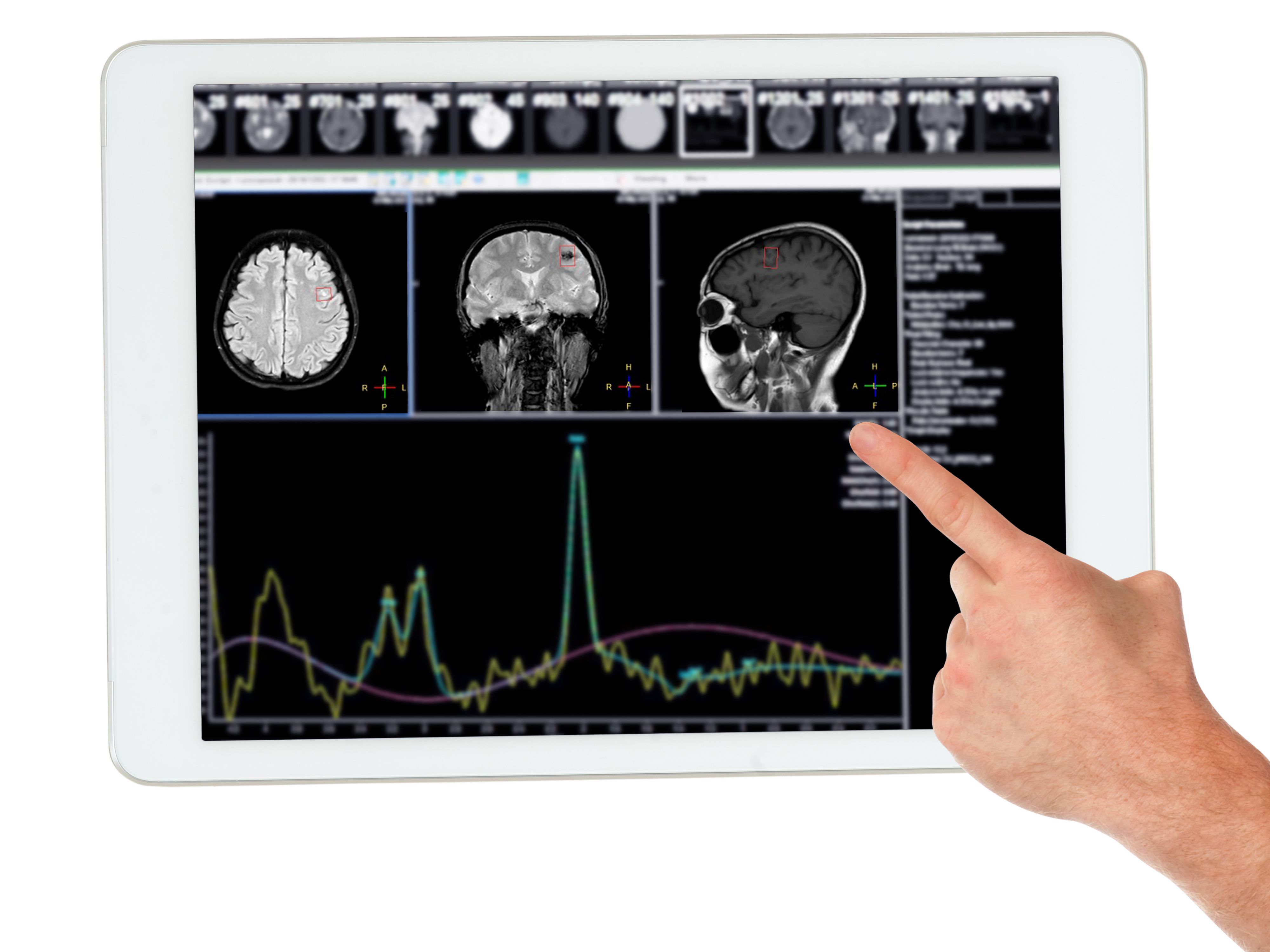 neurodiagnostic technology