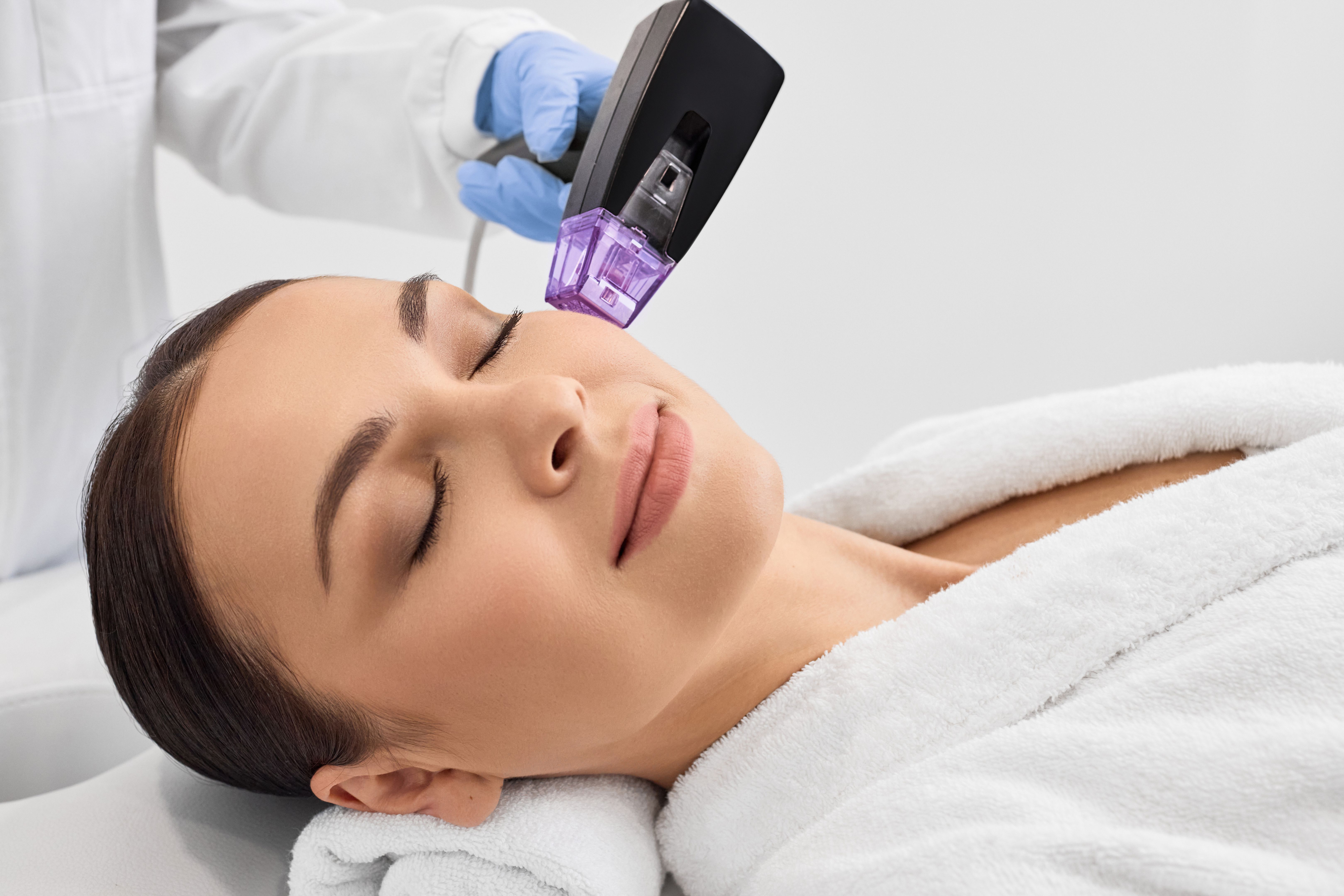 microneedling procedure