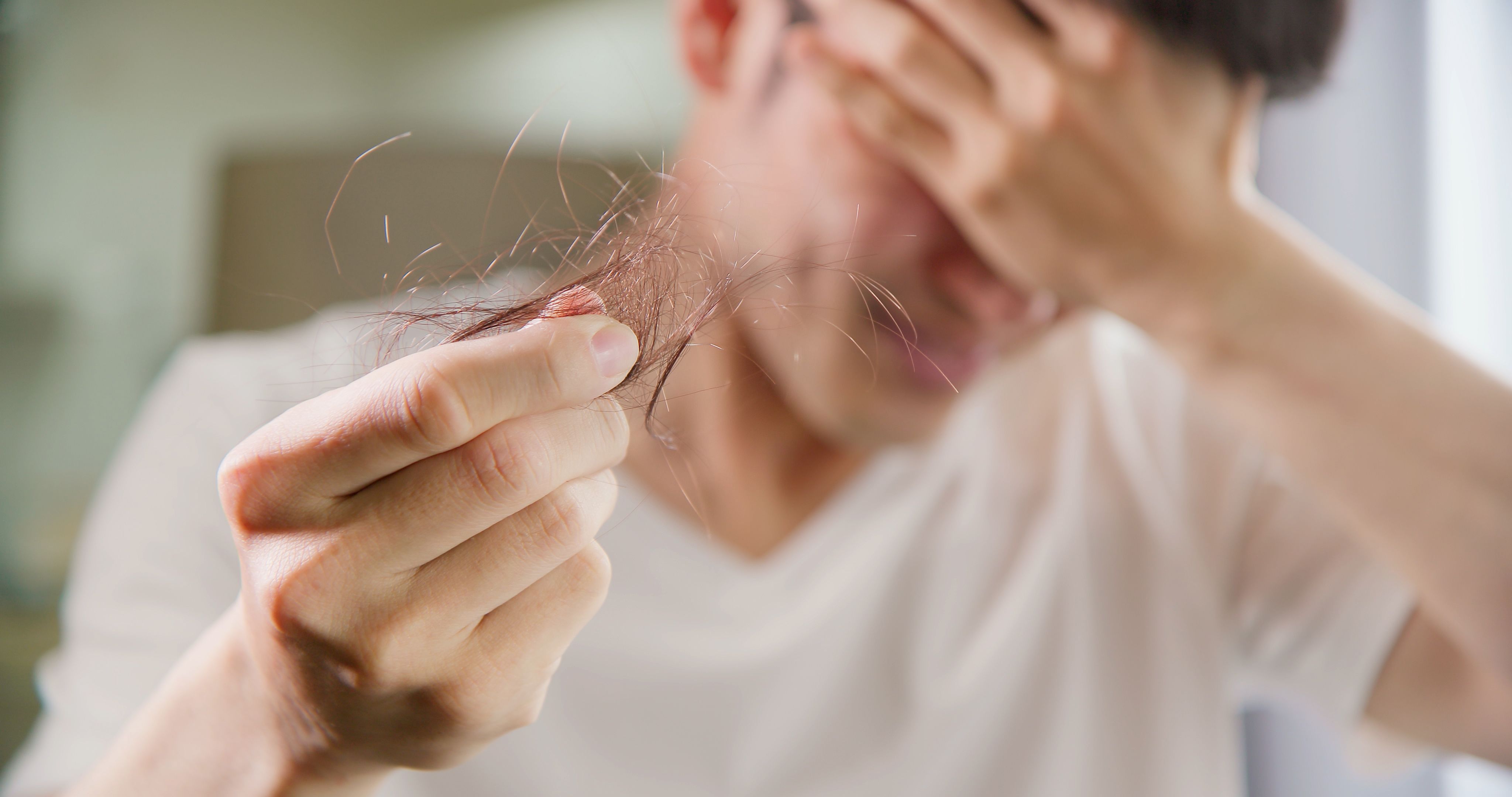 hair loss prp leicester stress hair loss prp leicester stress