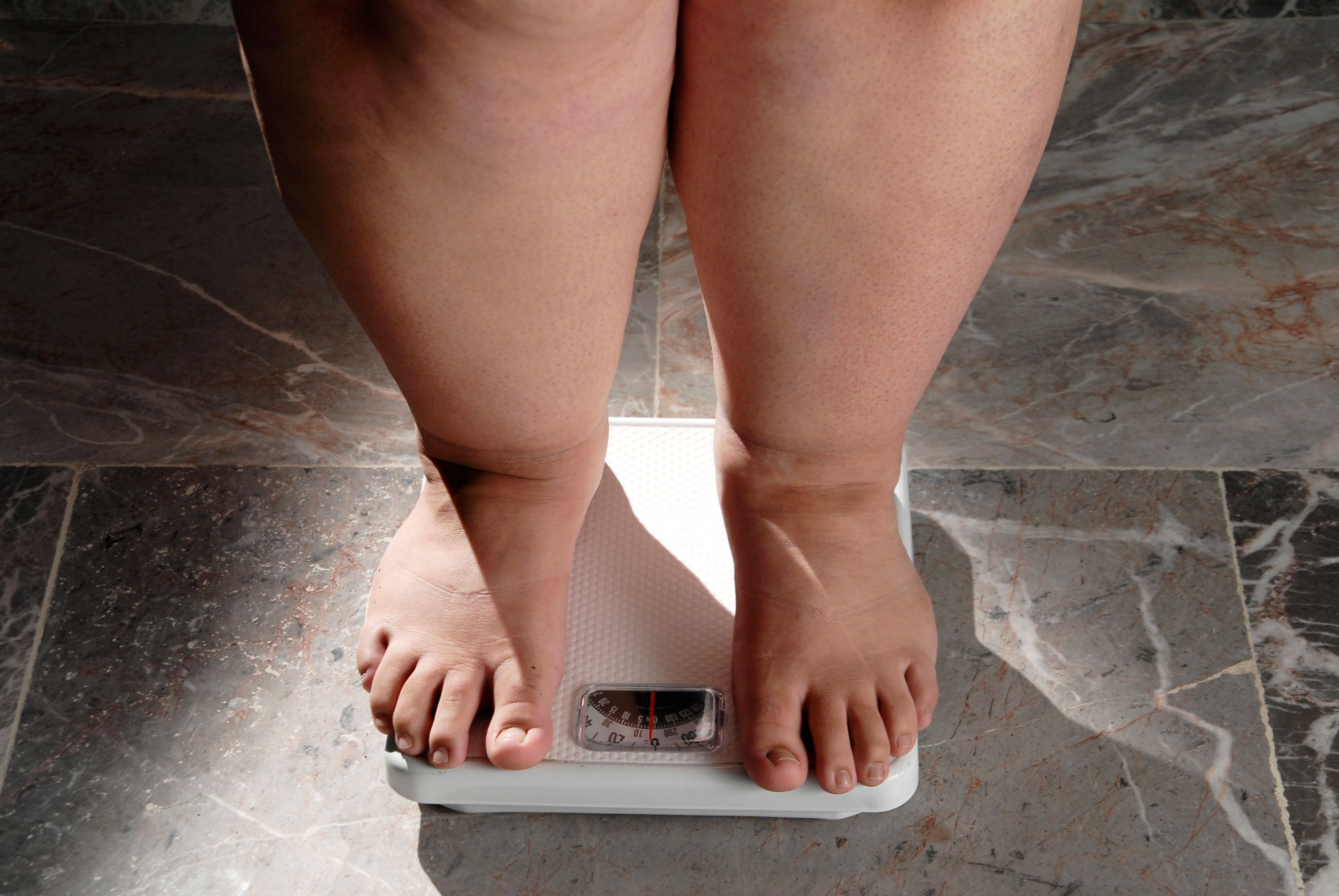 obesity and overweight, overweight woman feet on the scale, concept of obesity and bad habits