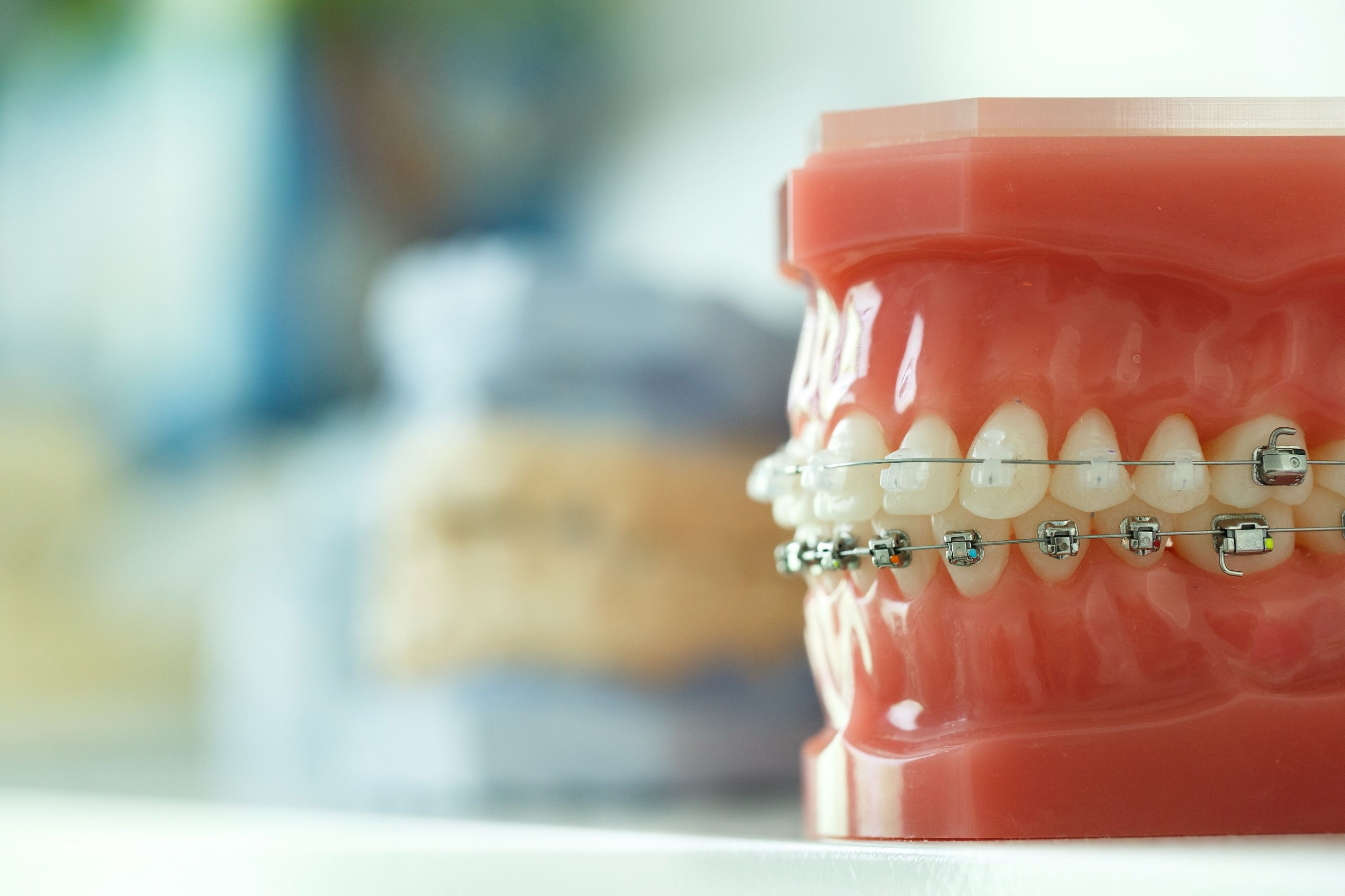 orthodontic model