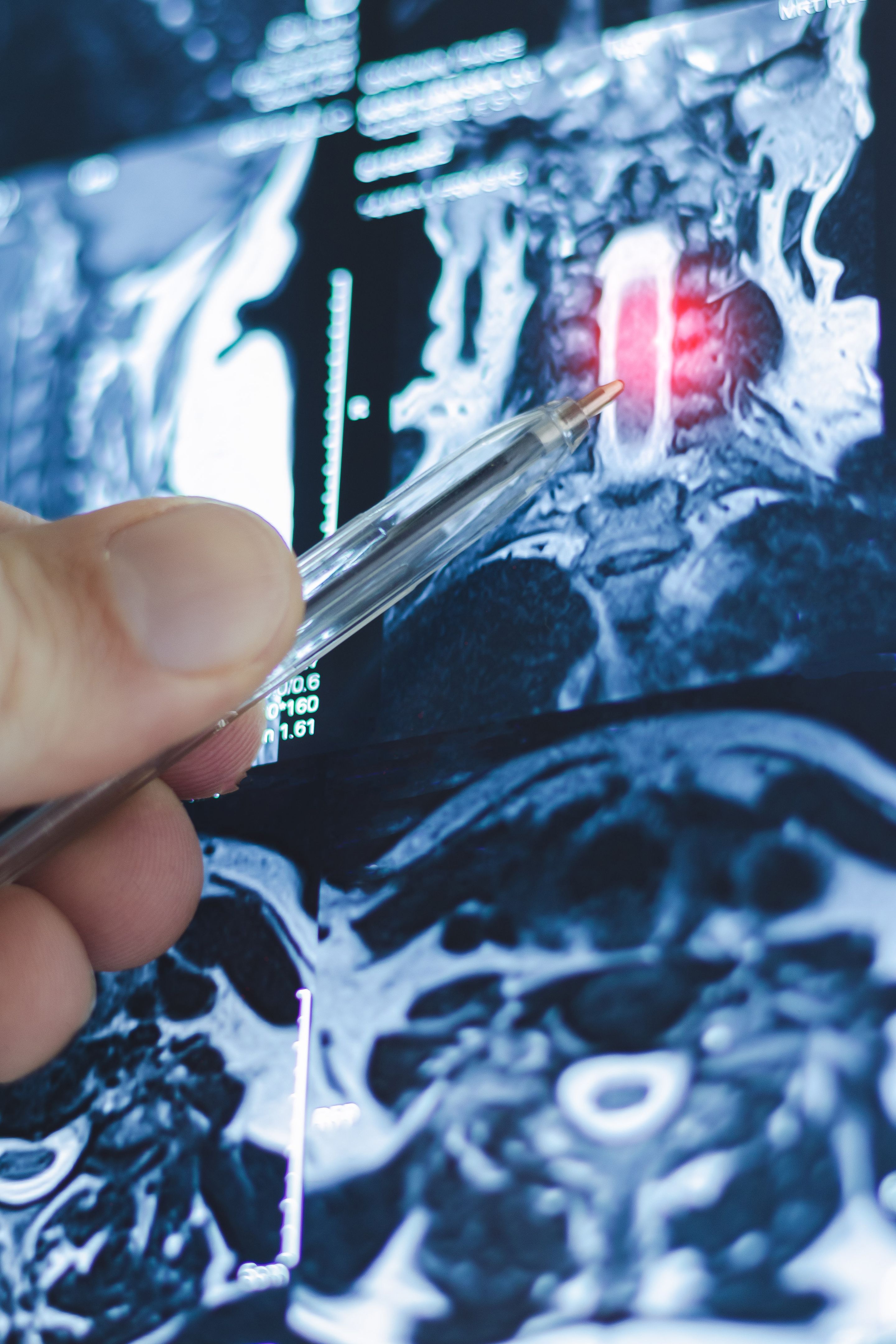 neurology consultation