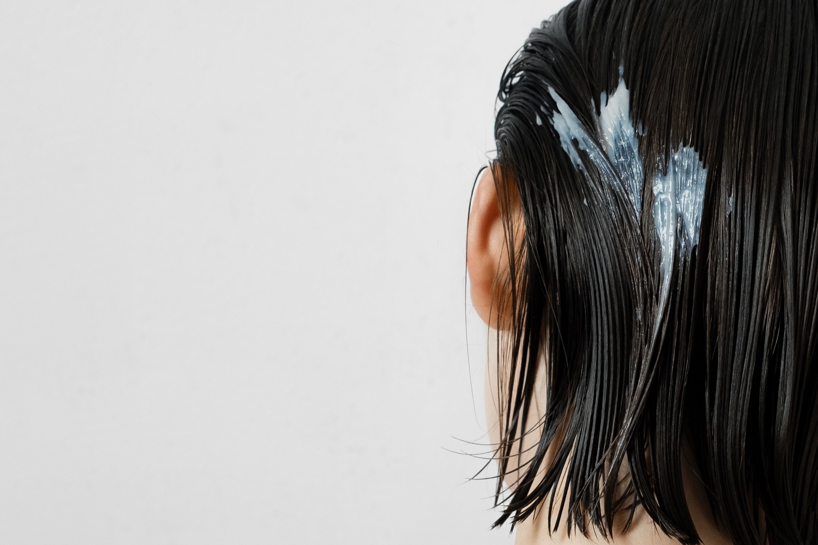 hair treatment prp leicester minoxidil