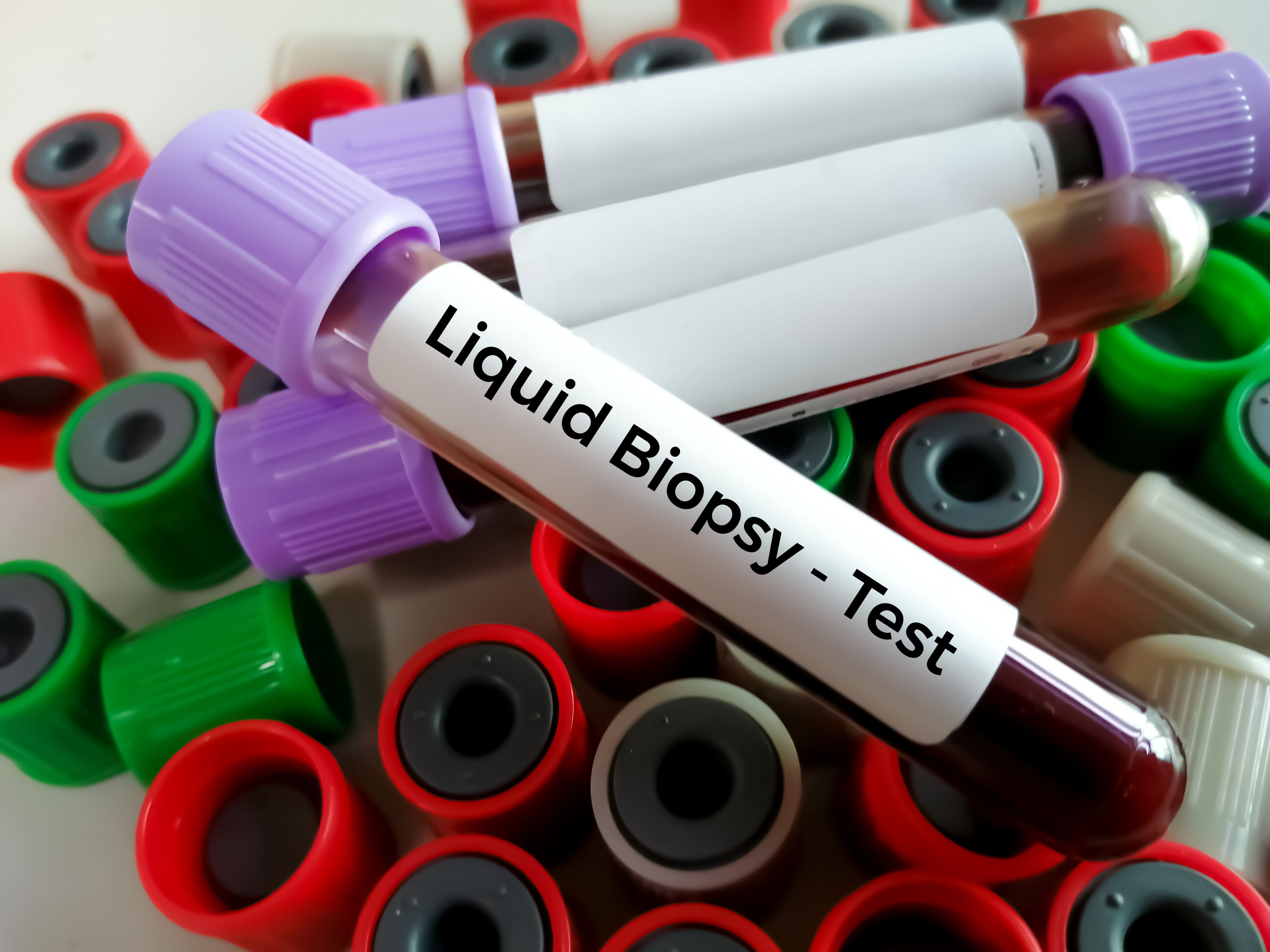 liquid biopsy