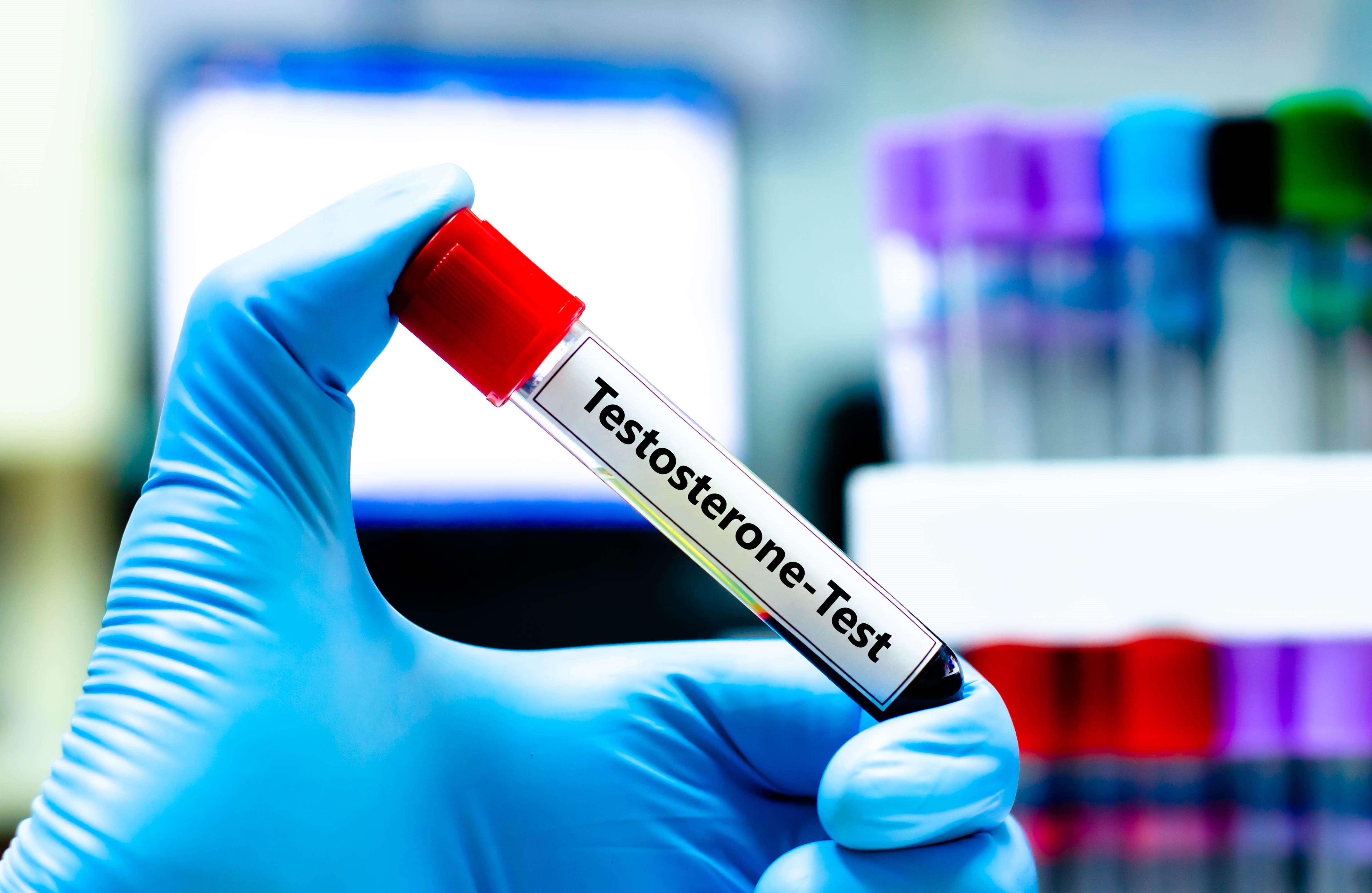 testosterone levels