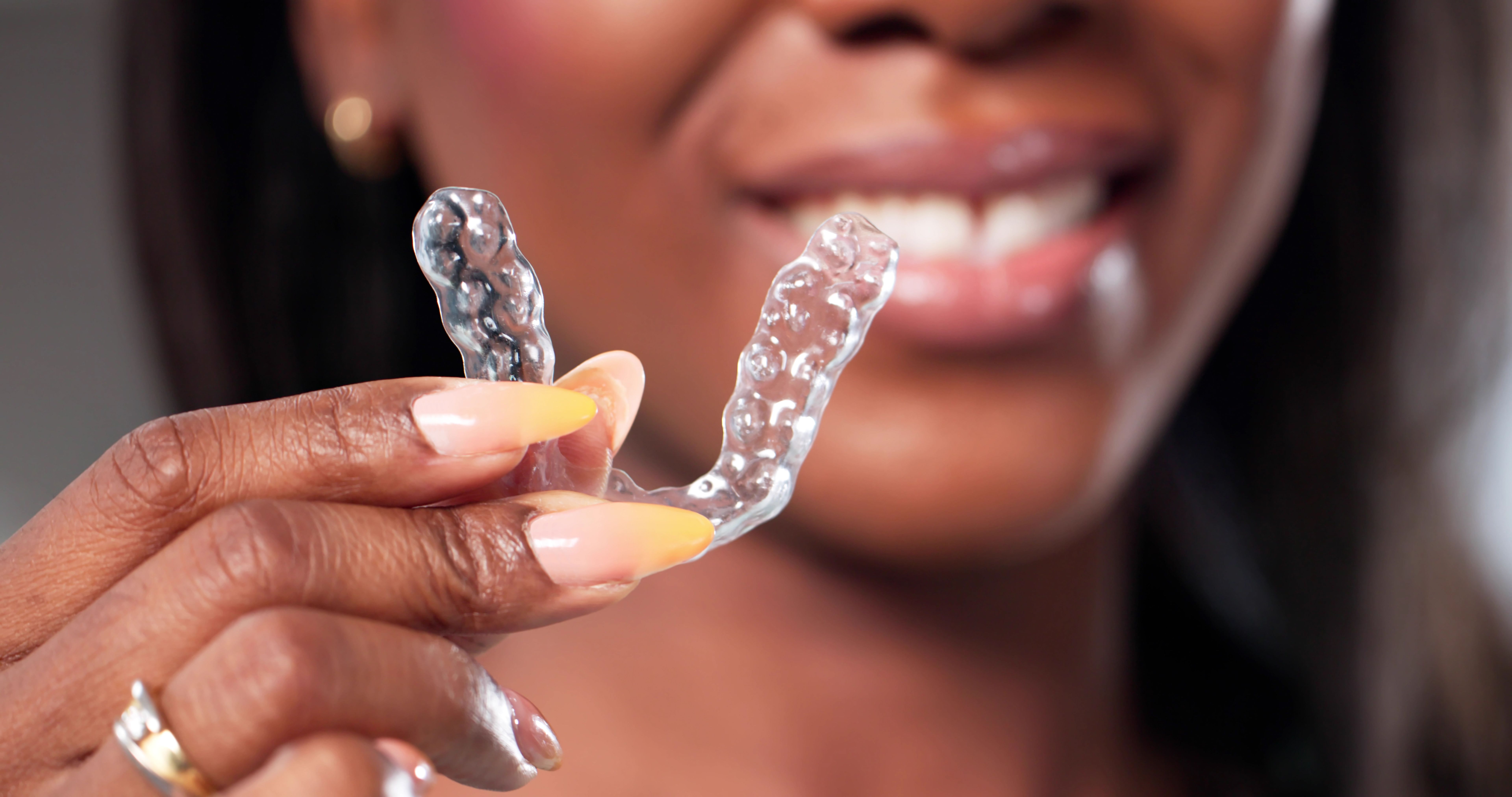 invisalign treatment