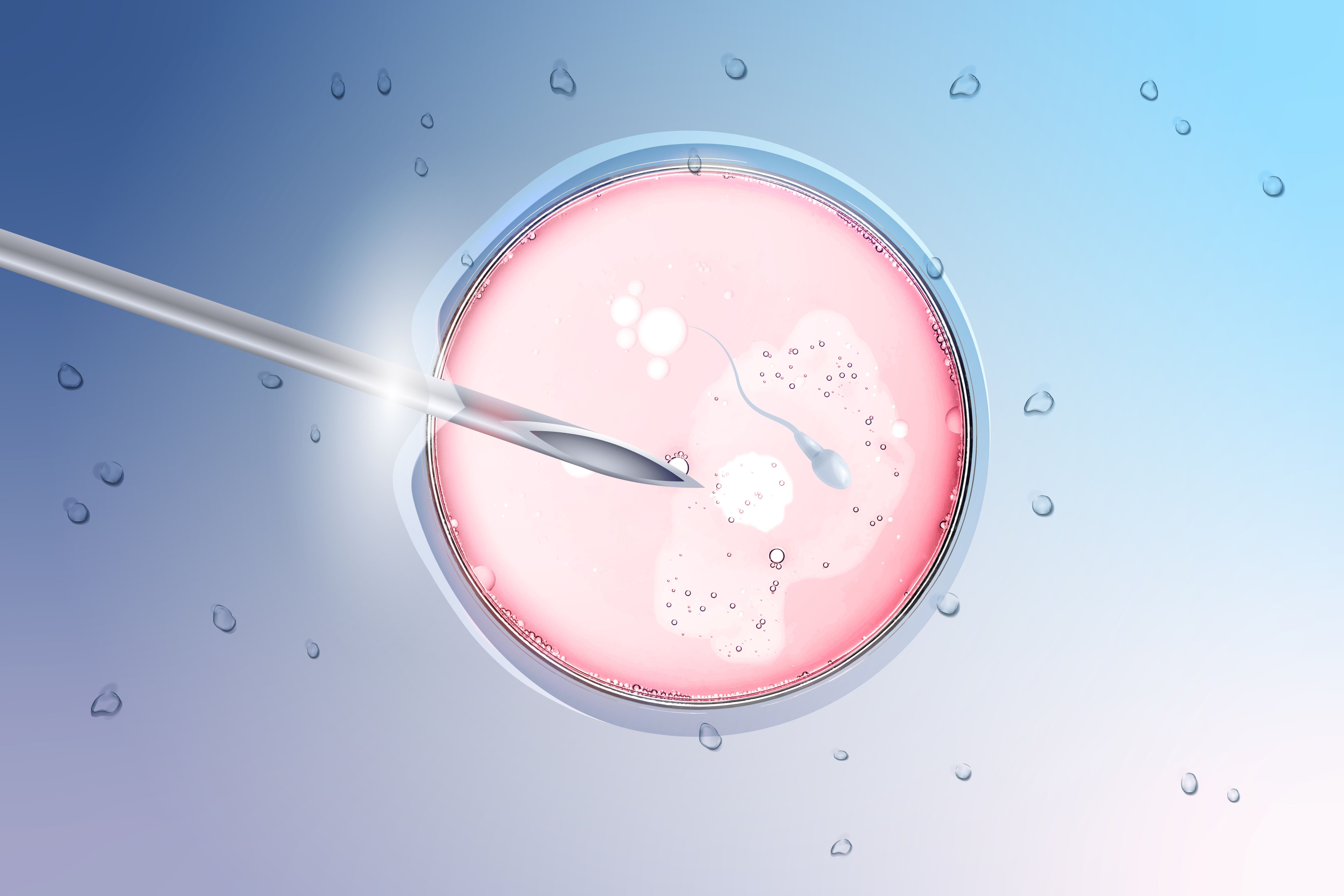 ivf procedure
