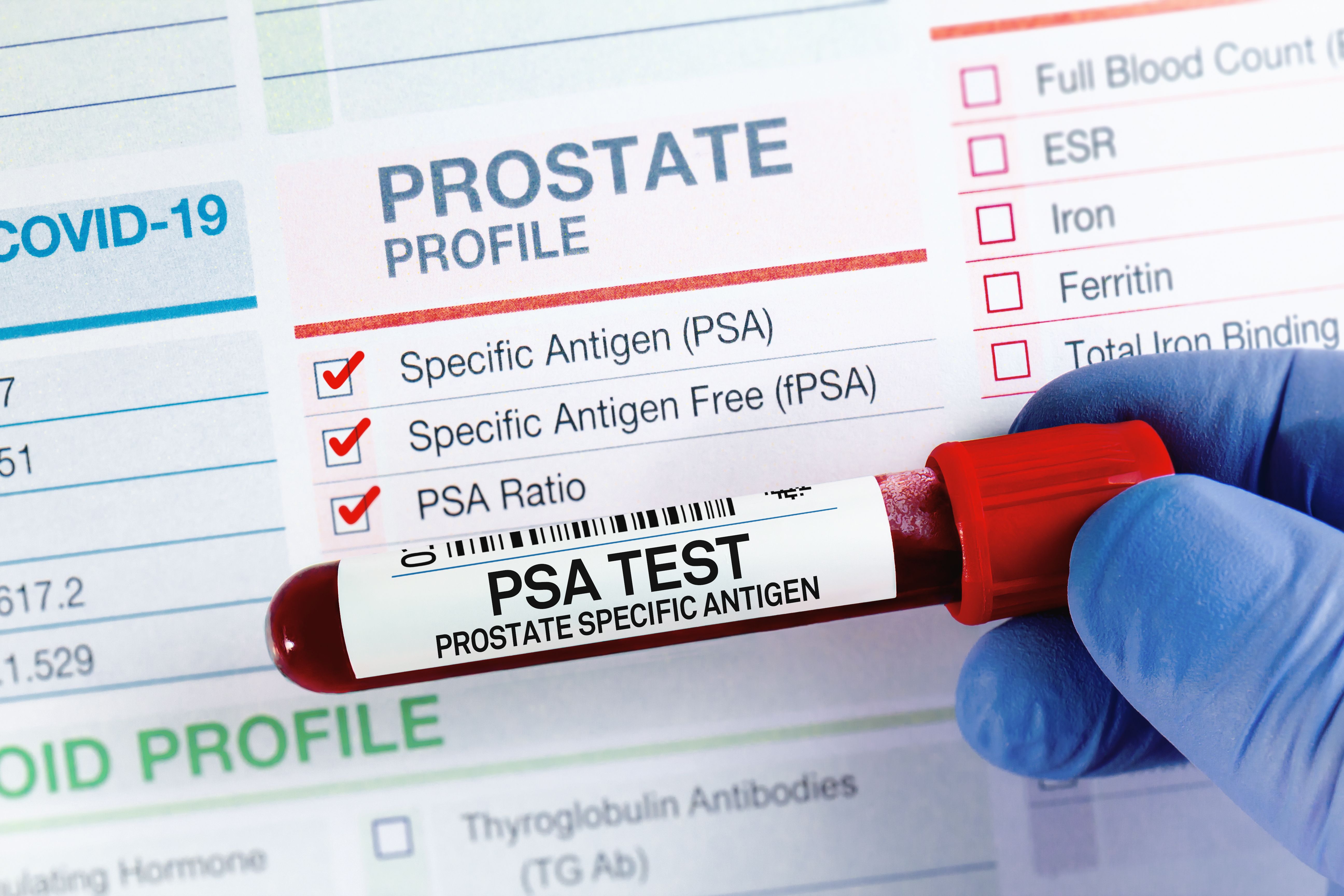 prostate screening
