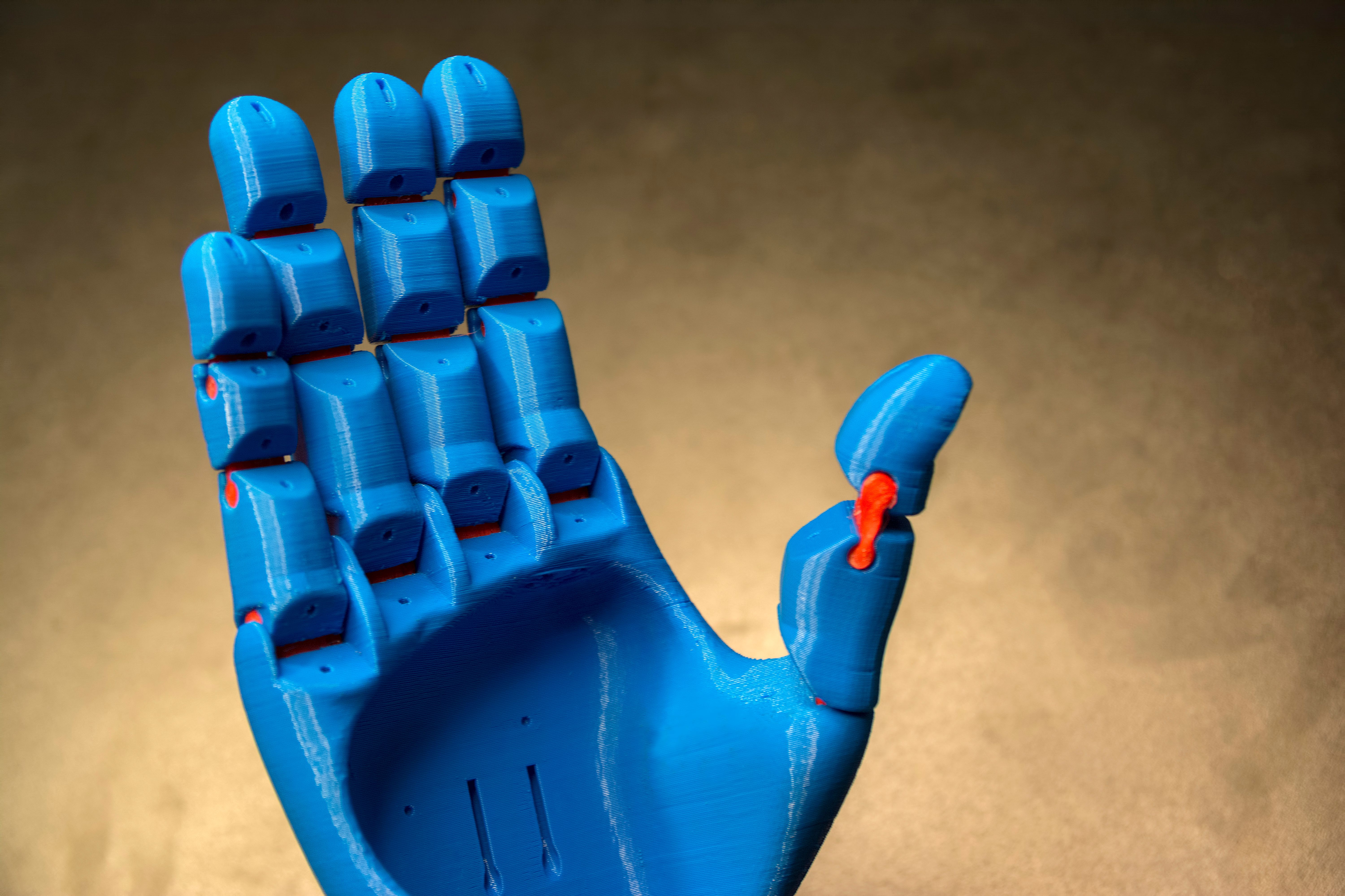 3d model prosthetics