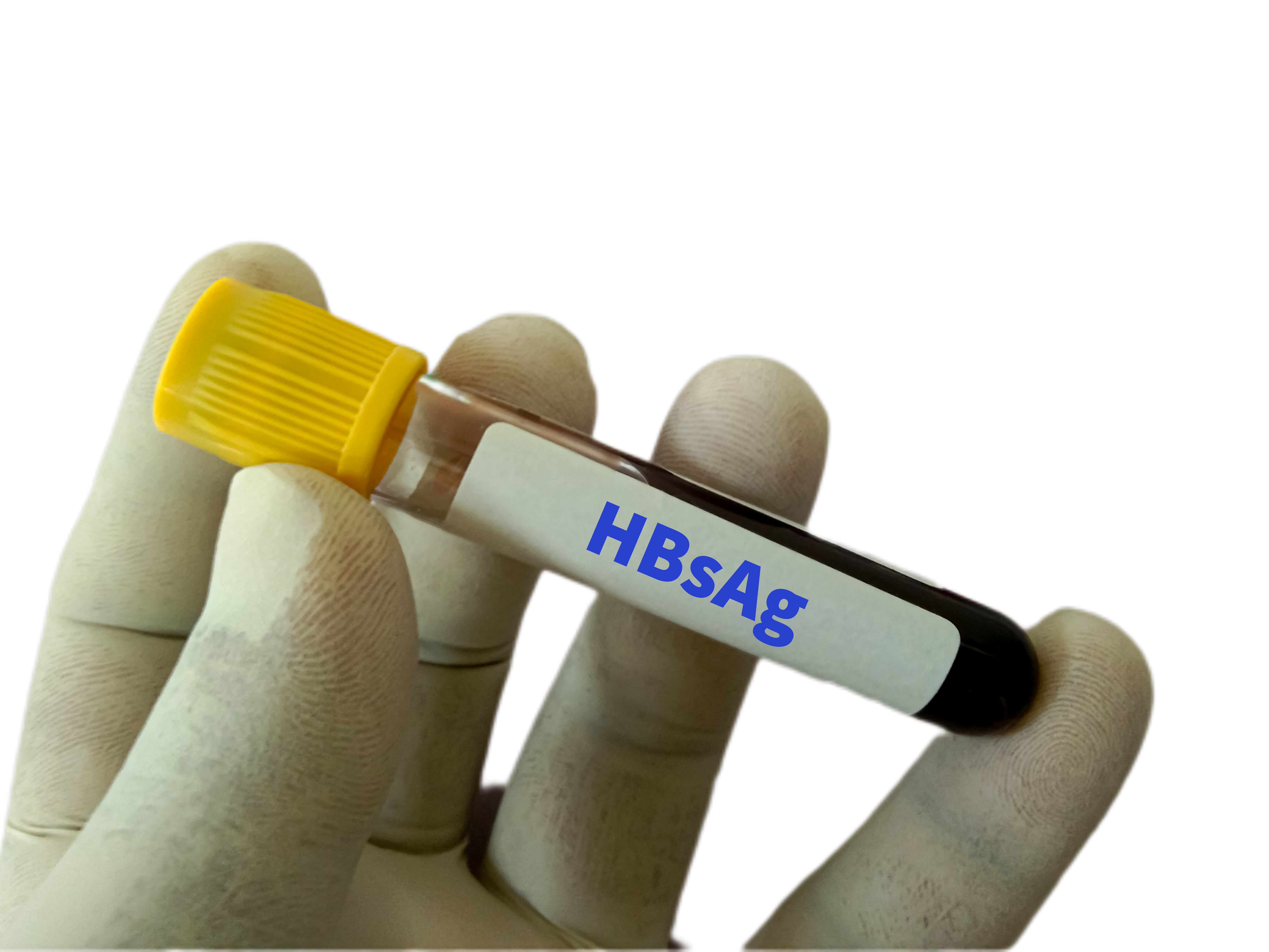 solano county school