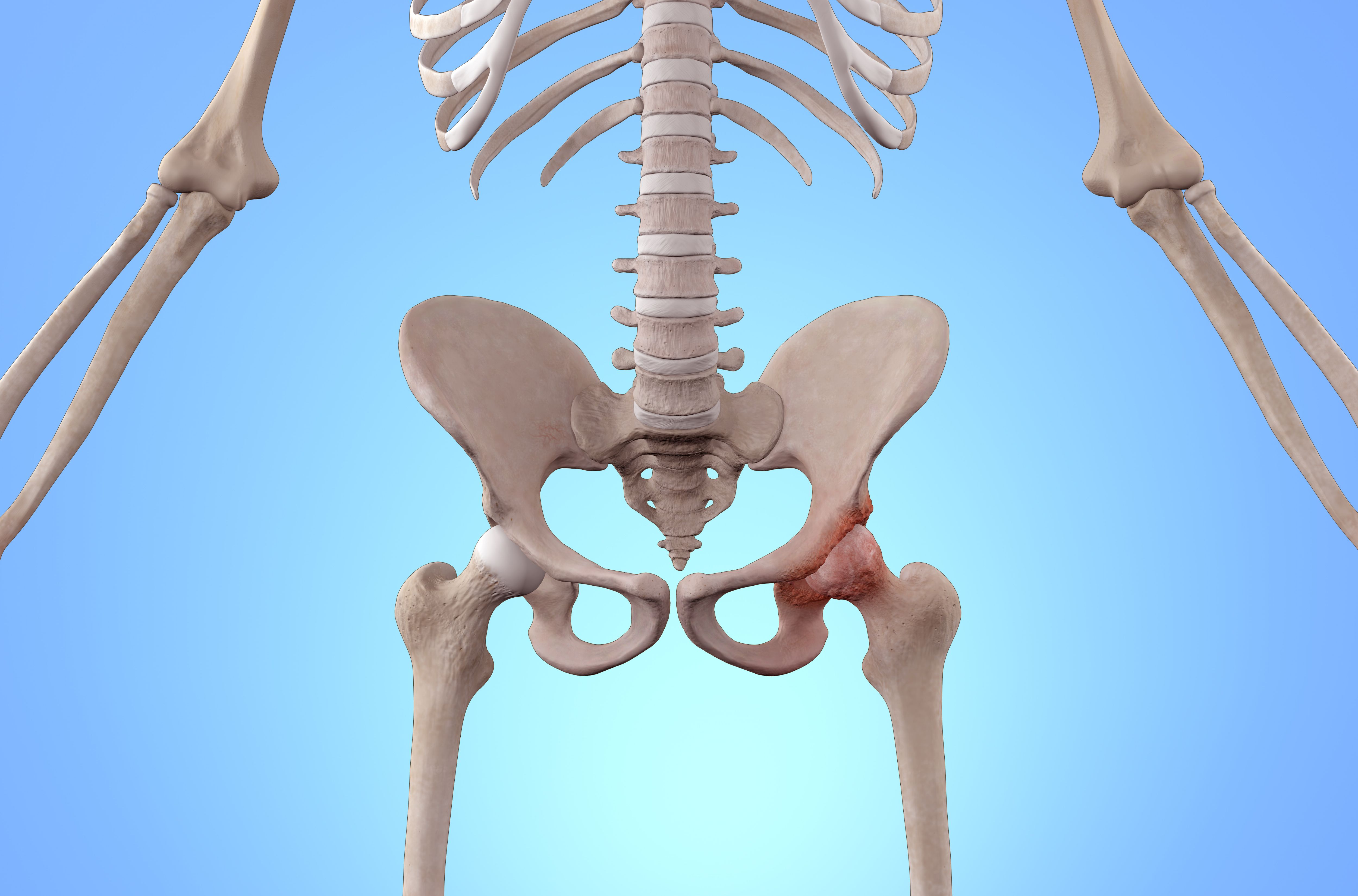 pelvic exercise