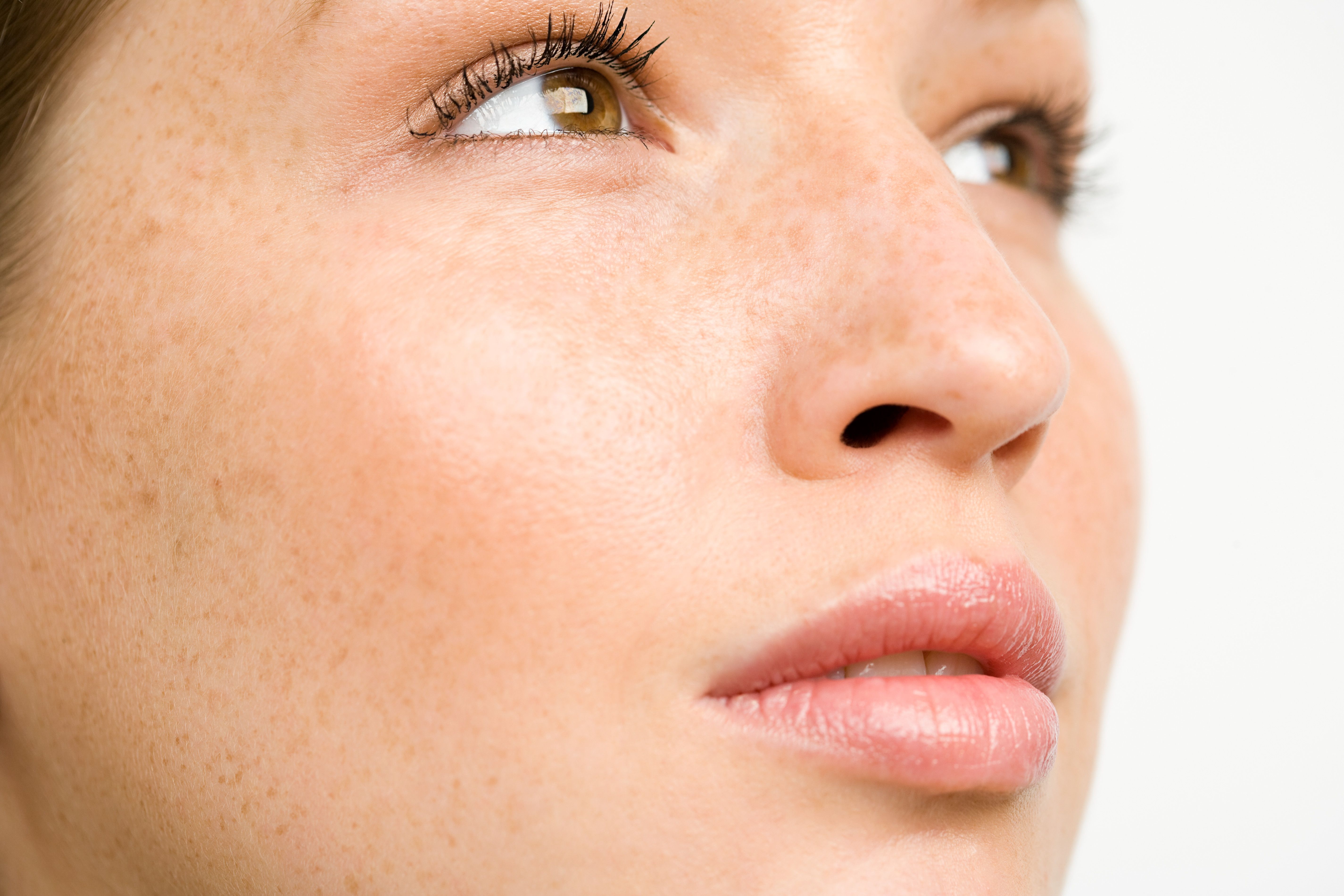 skin types