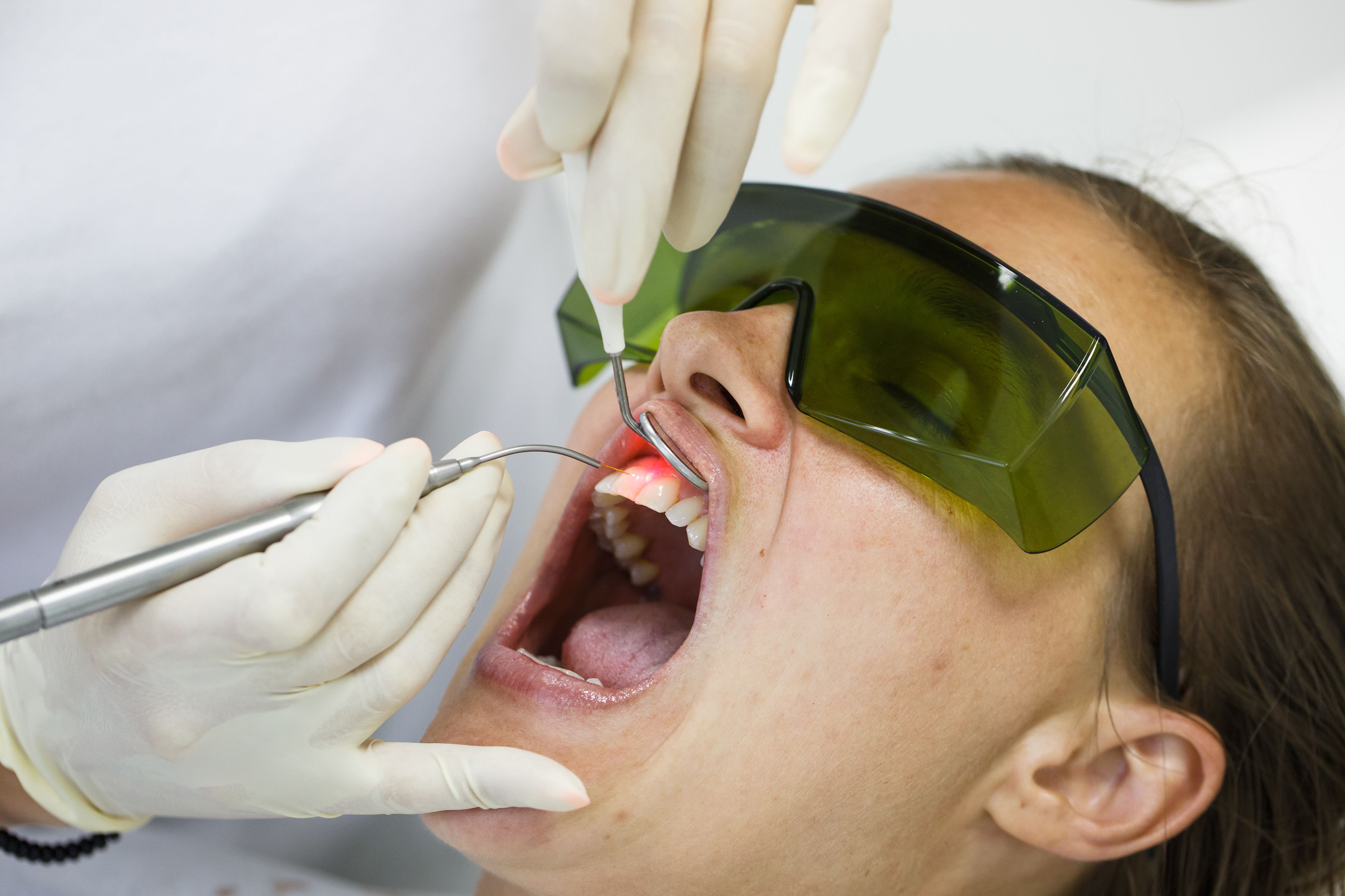 laser dental treatment