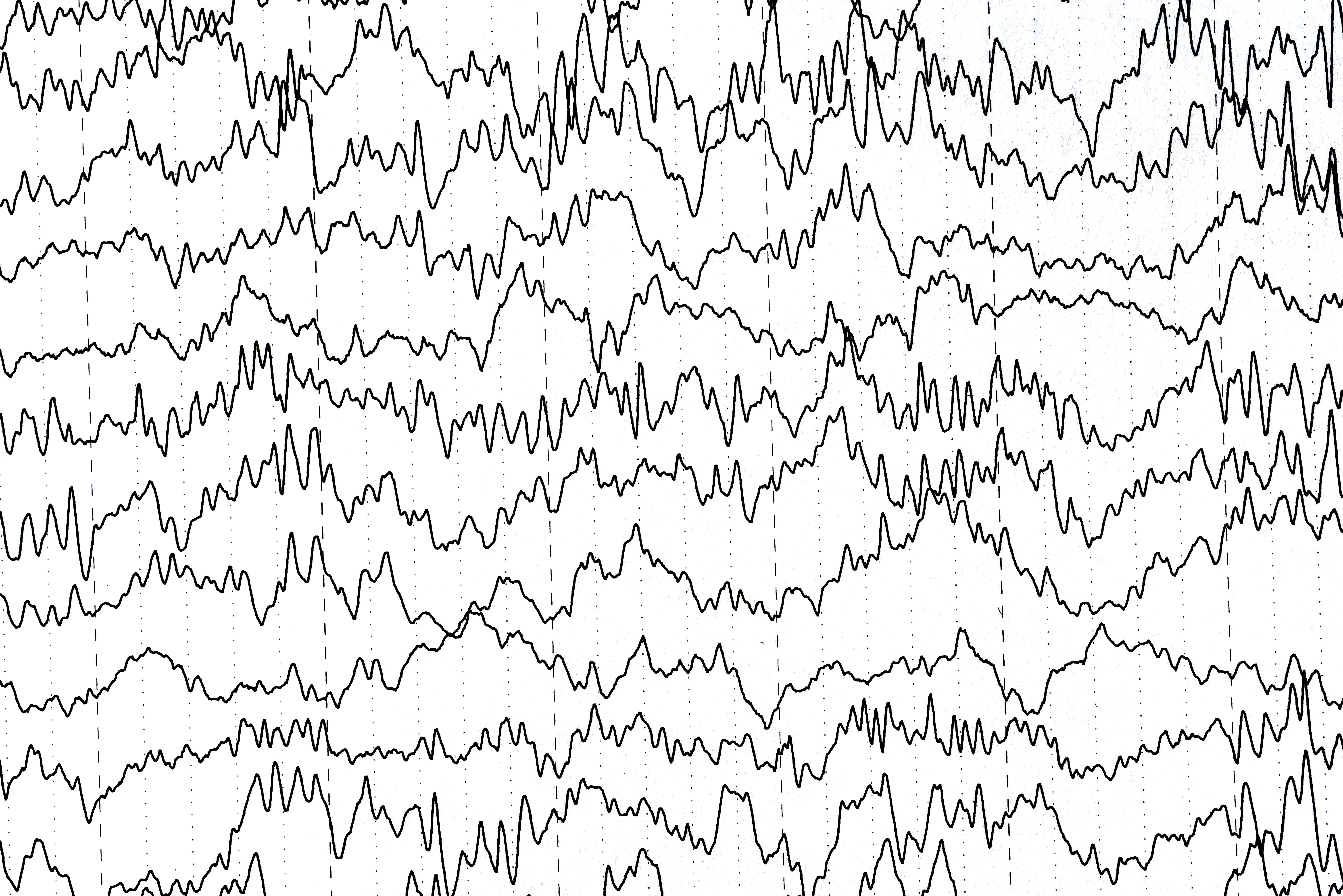 high-density EEG