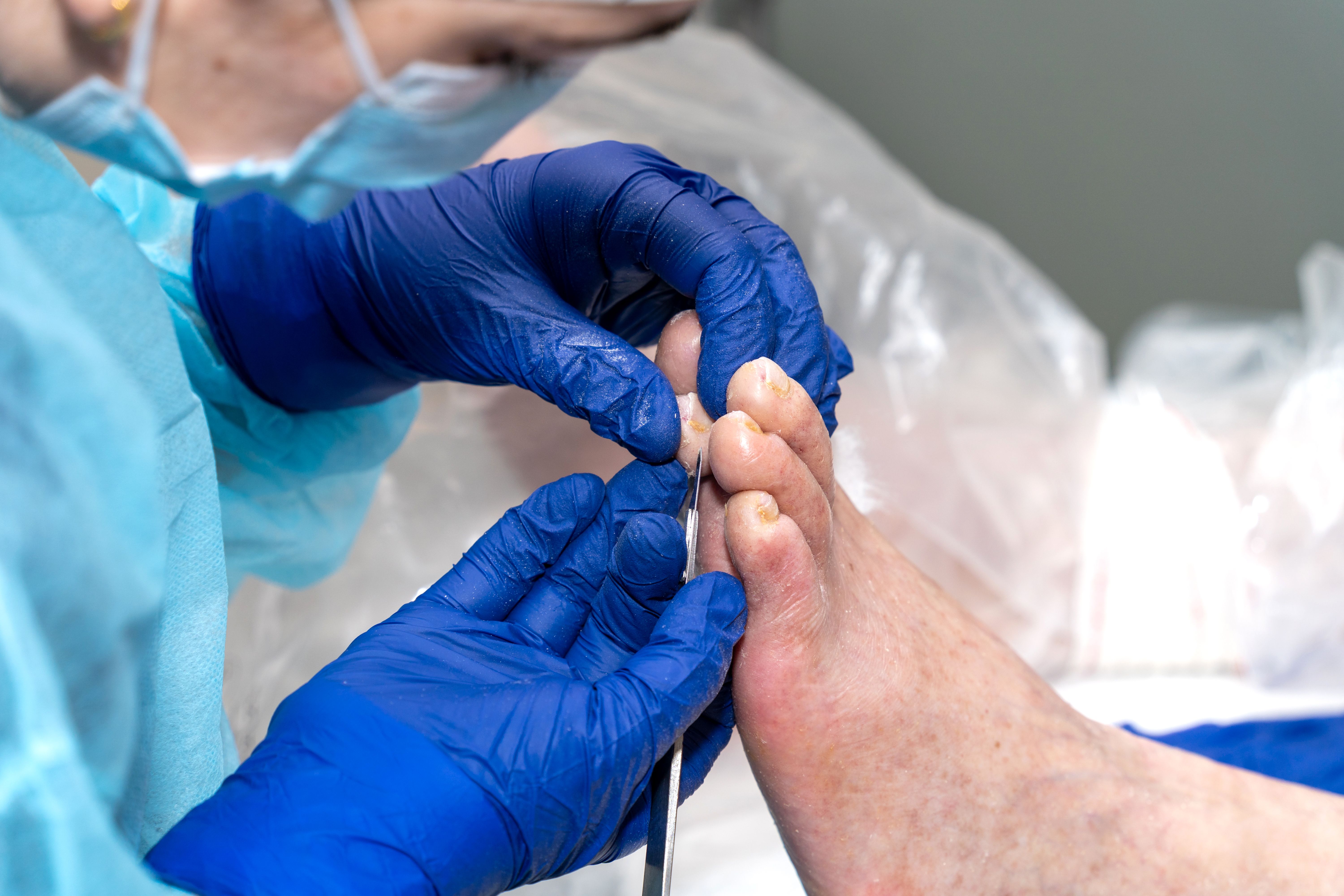 Podiatrist removing cuticle and dry skin on an older patient's nails in the clinic. Podiatrist removing cuticle and dry skin on an older patient's nails in the clinic.