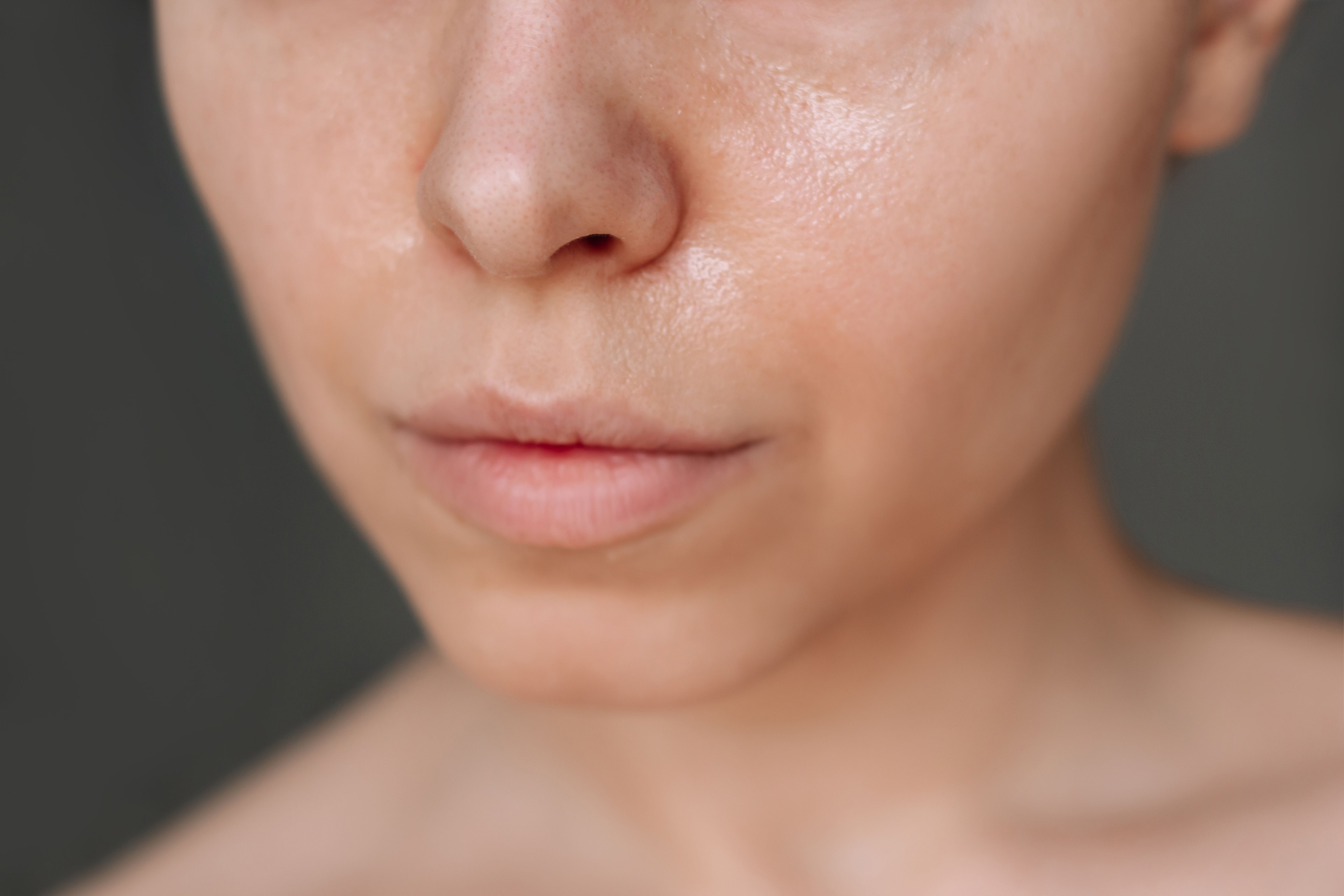 woman with oily skin