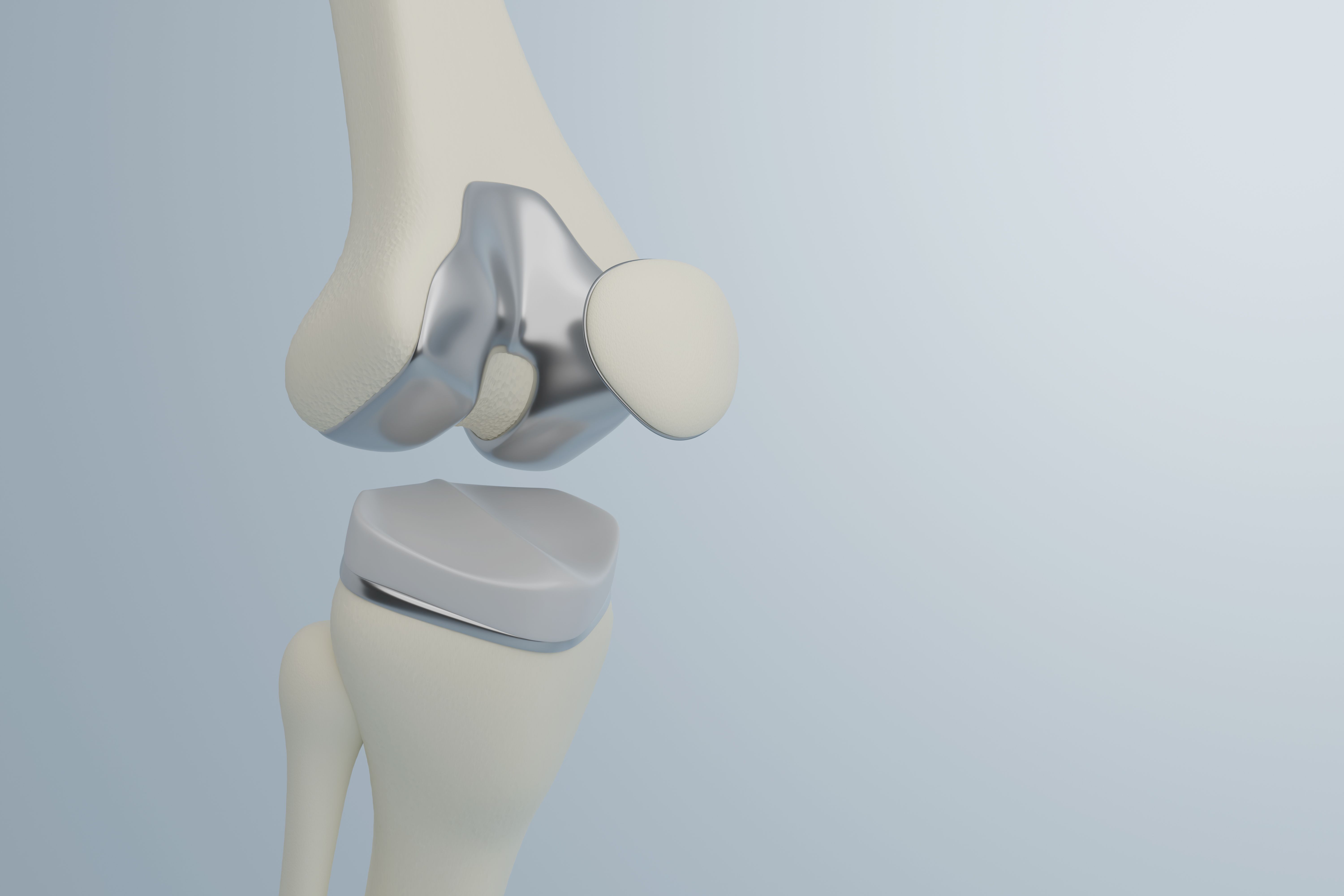 joint replacement
