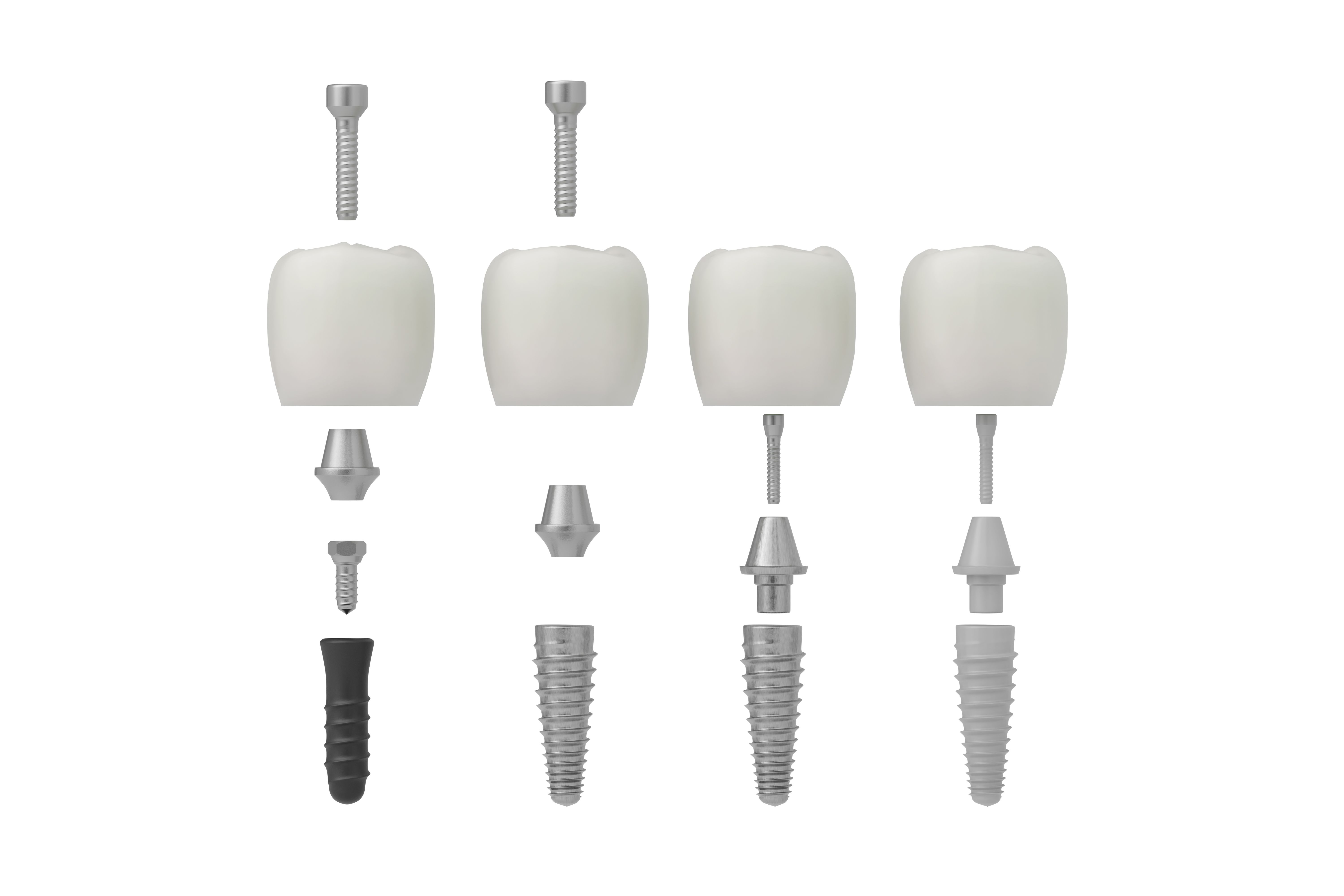 Comparison of Various Dental Implants: Cemented, Screw-Retained, Zirconia and Metal Components