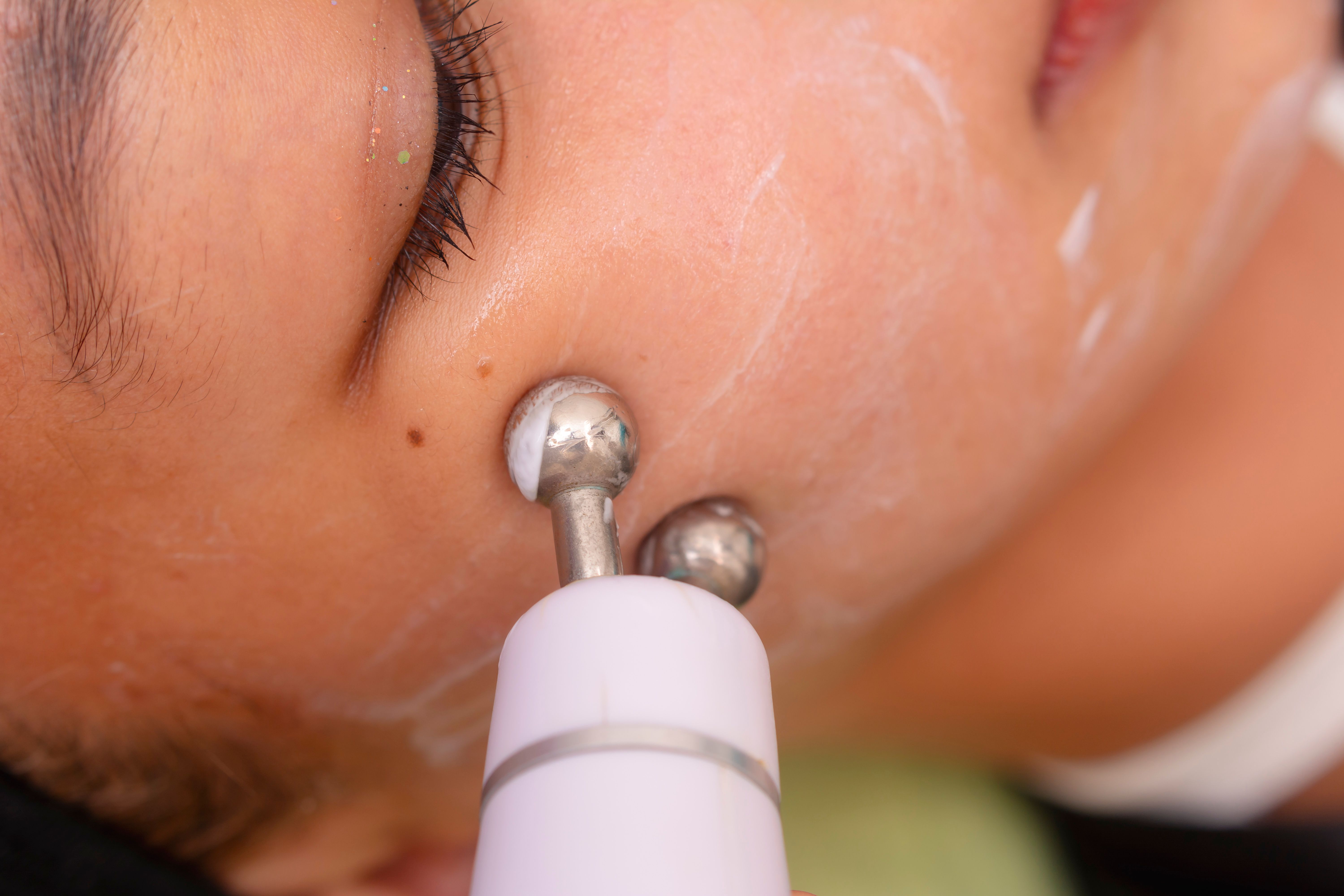 Close-up of a person's face undergoing a microcurrent facial therapy at a beauty clinic, highlighting skincare treatment and facial rejuvenation. Close-up of a person's face undergoing a microcurrent facial therapy at a beauty clinic, highlighting skincare treatment and facial rejuvenation.