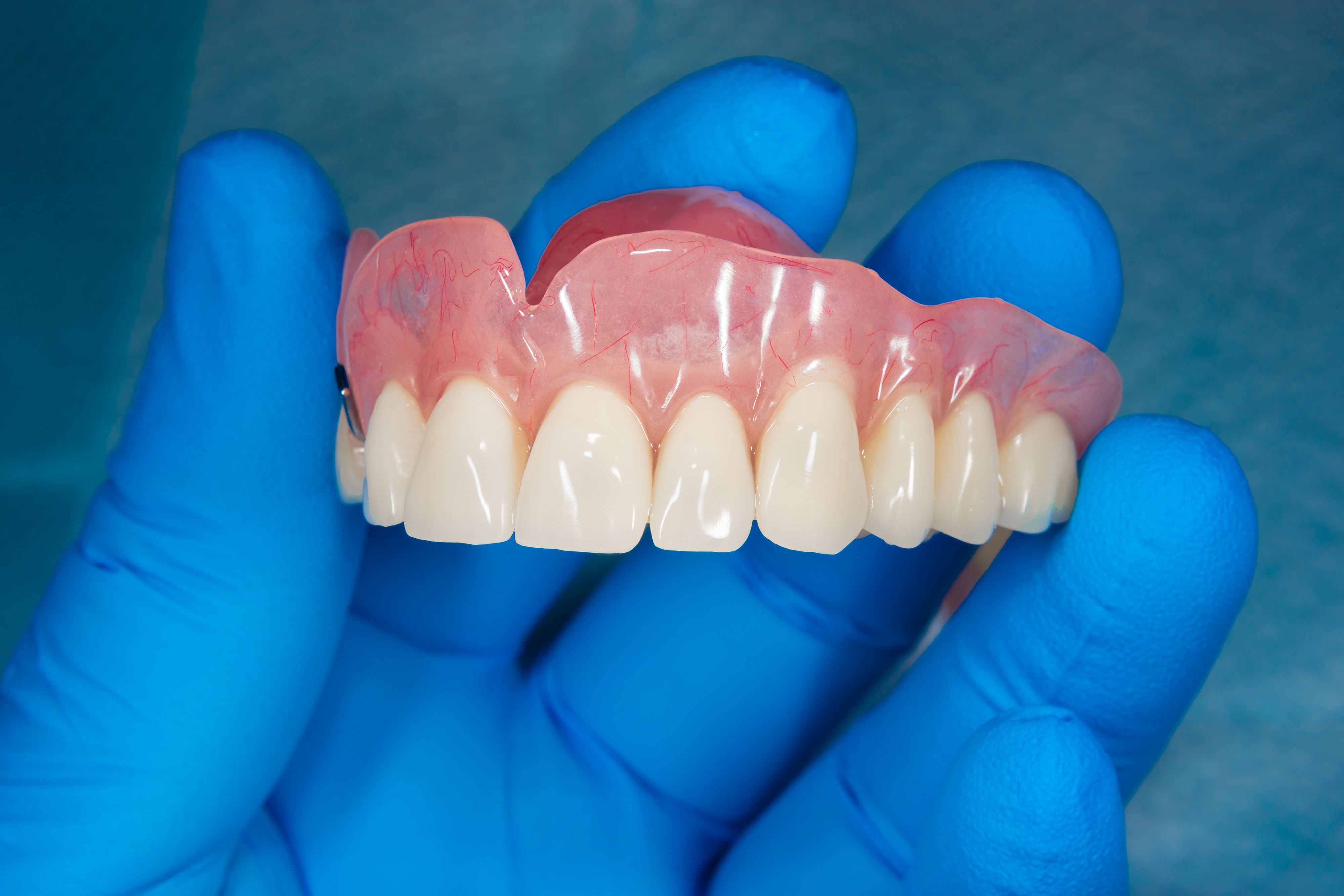 removable dental appliance