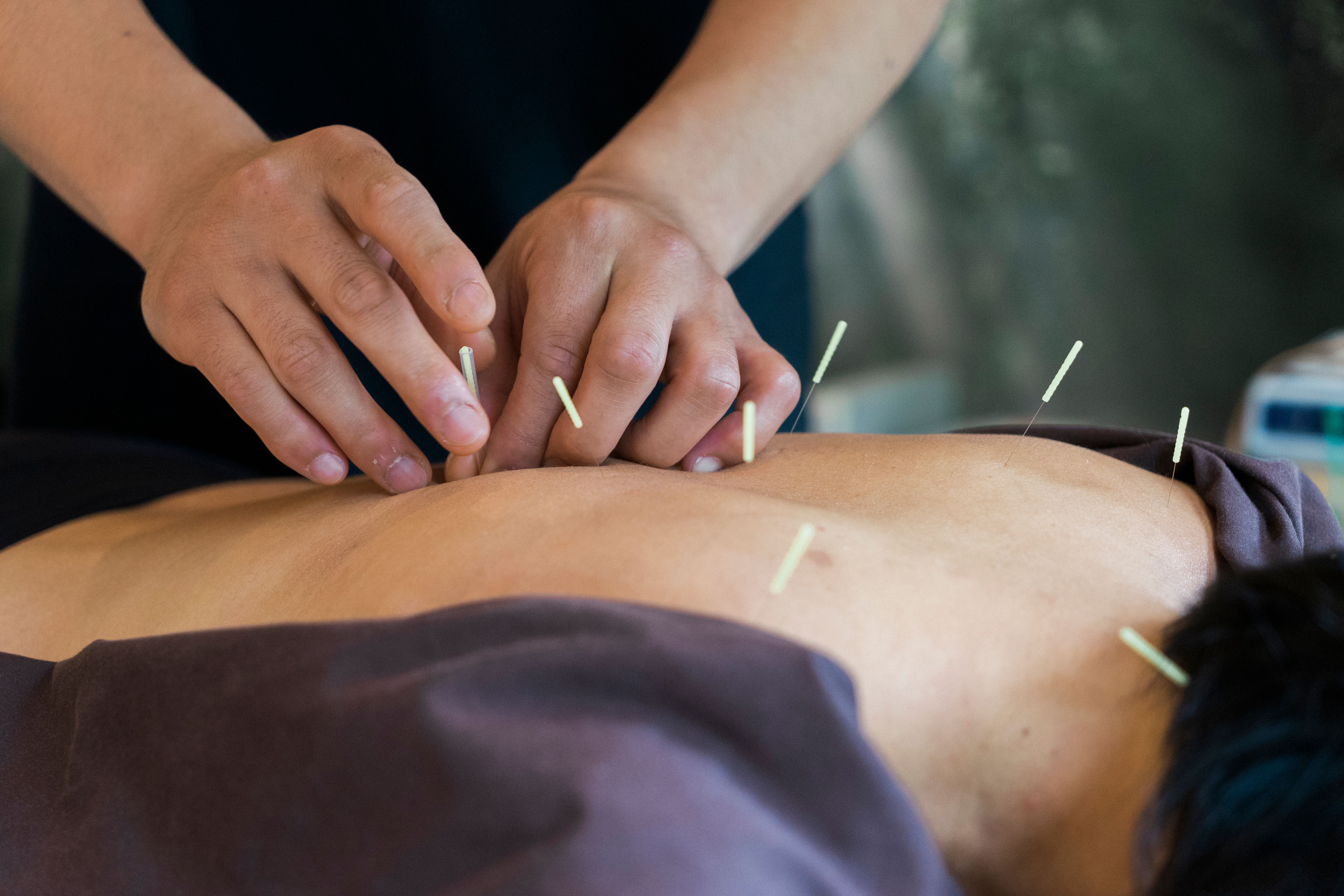 modern acupuncture clinic
